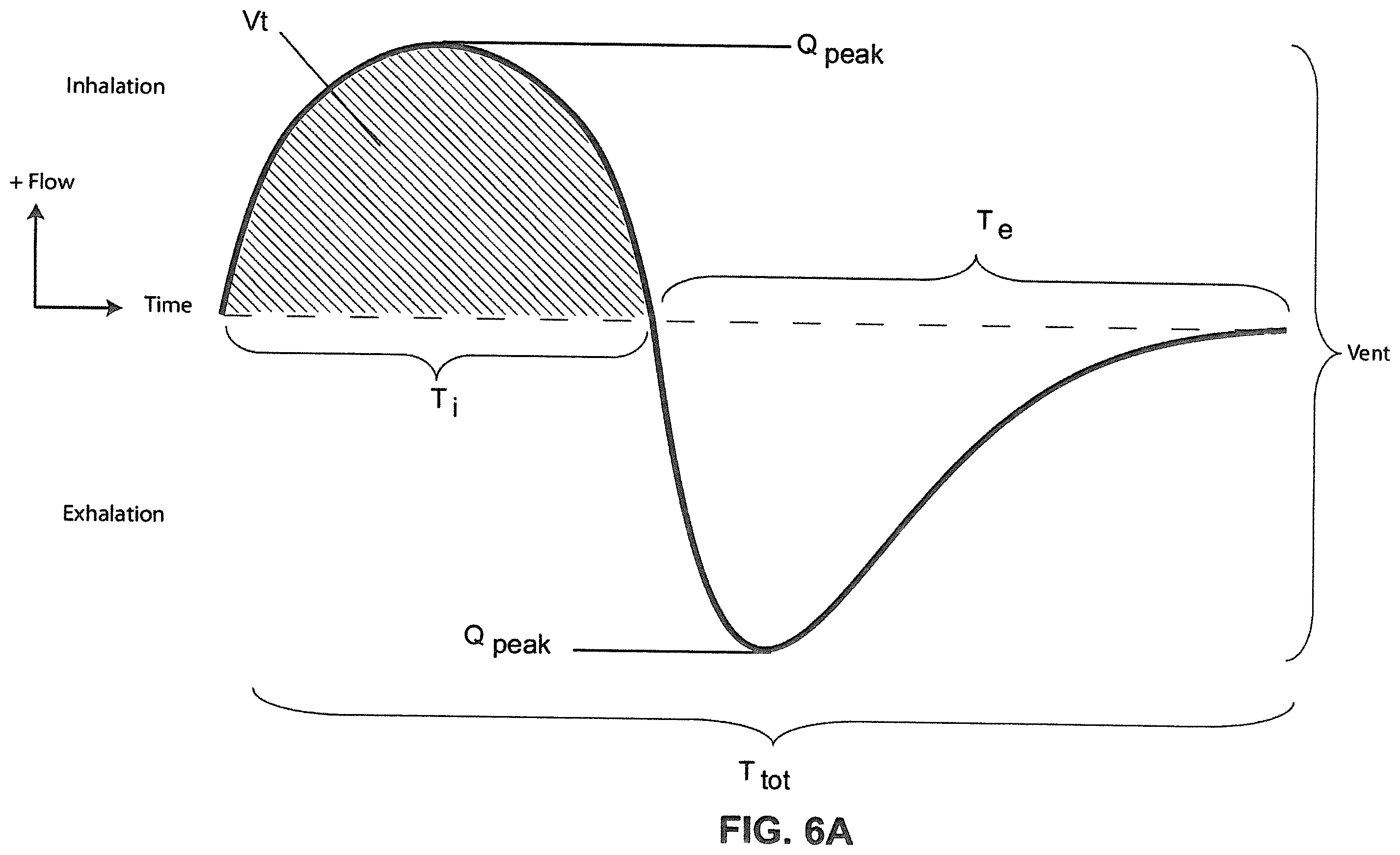 Patent US12350034 Figure 7 – Methods and apparatus for detection of disordered breathing