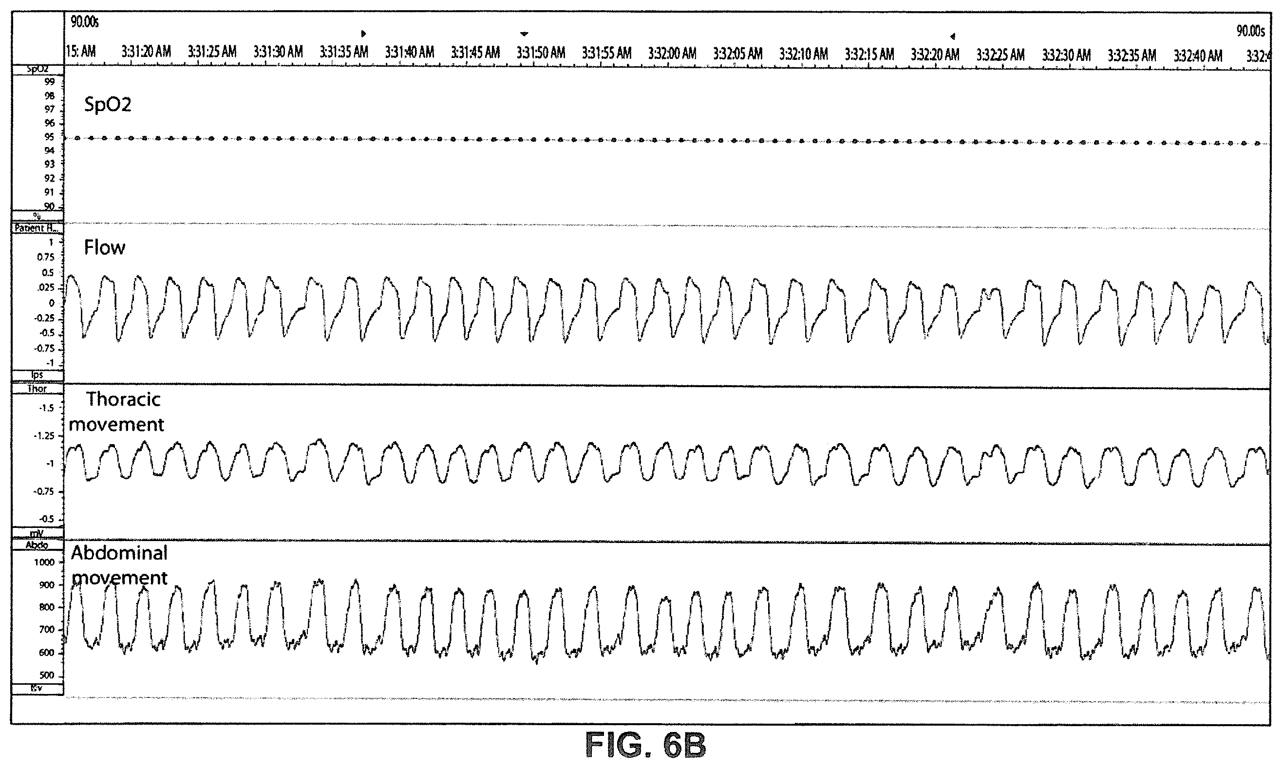 Patent US12350034 Figure 8 – Methods and apparatus for detection of disordered breathing