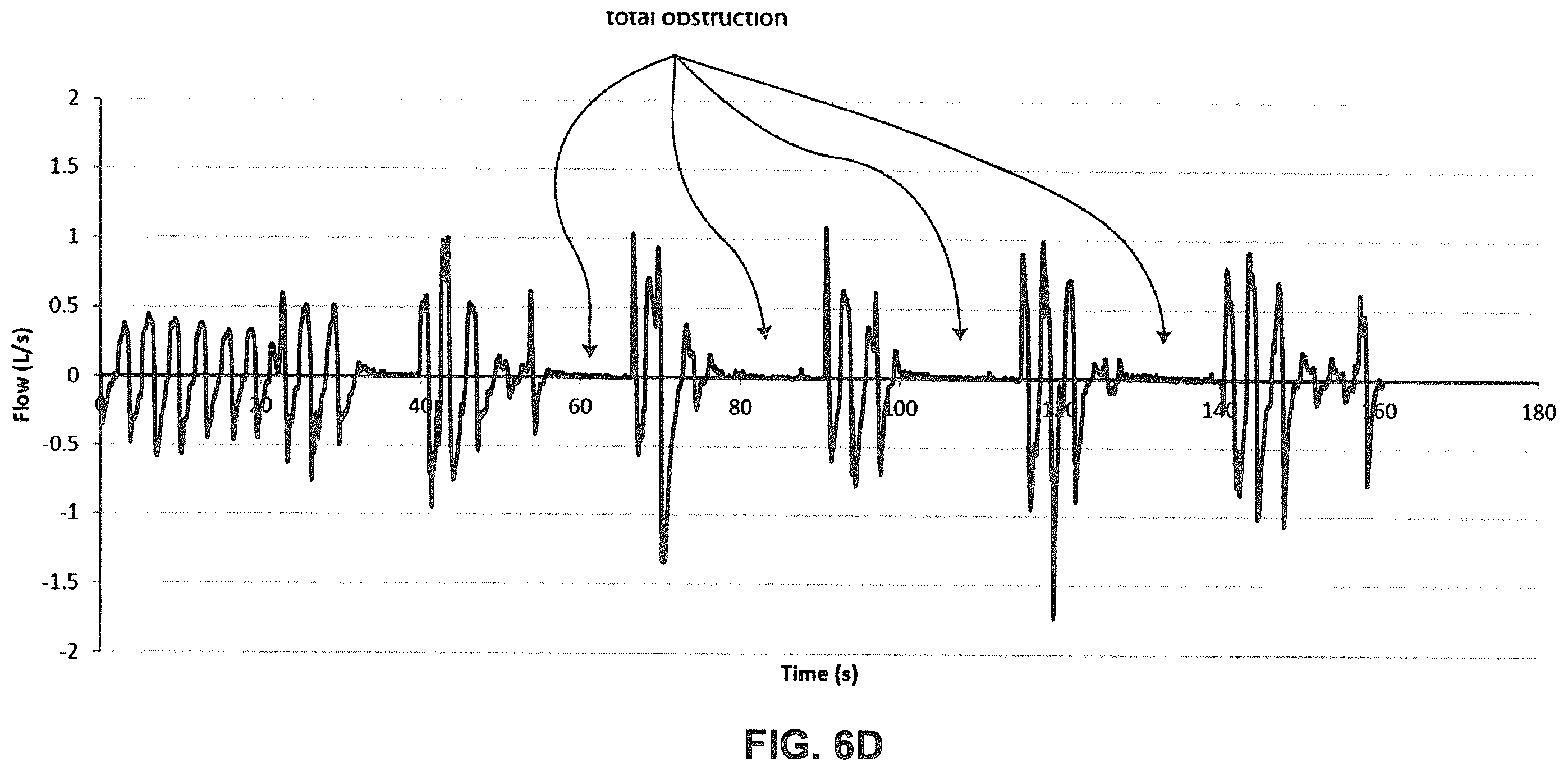 Patent US12350034 Figure 10 – Methods and apparatus for detection of disordered breathing