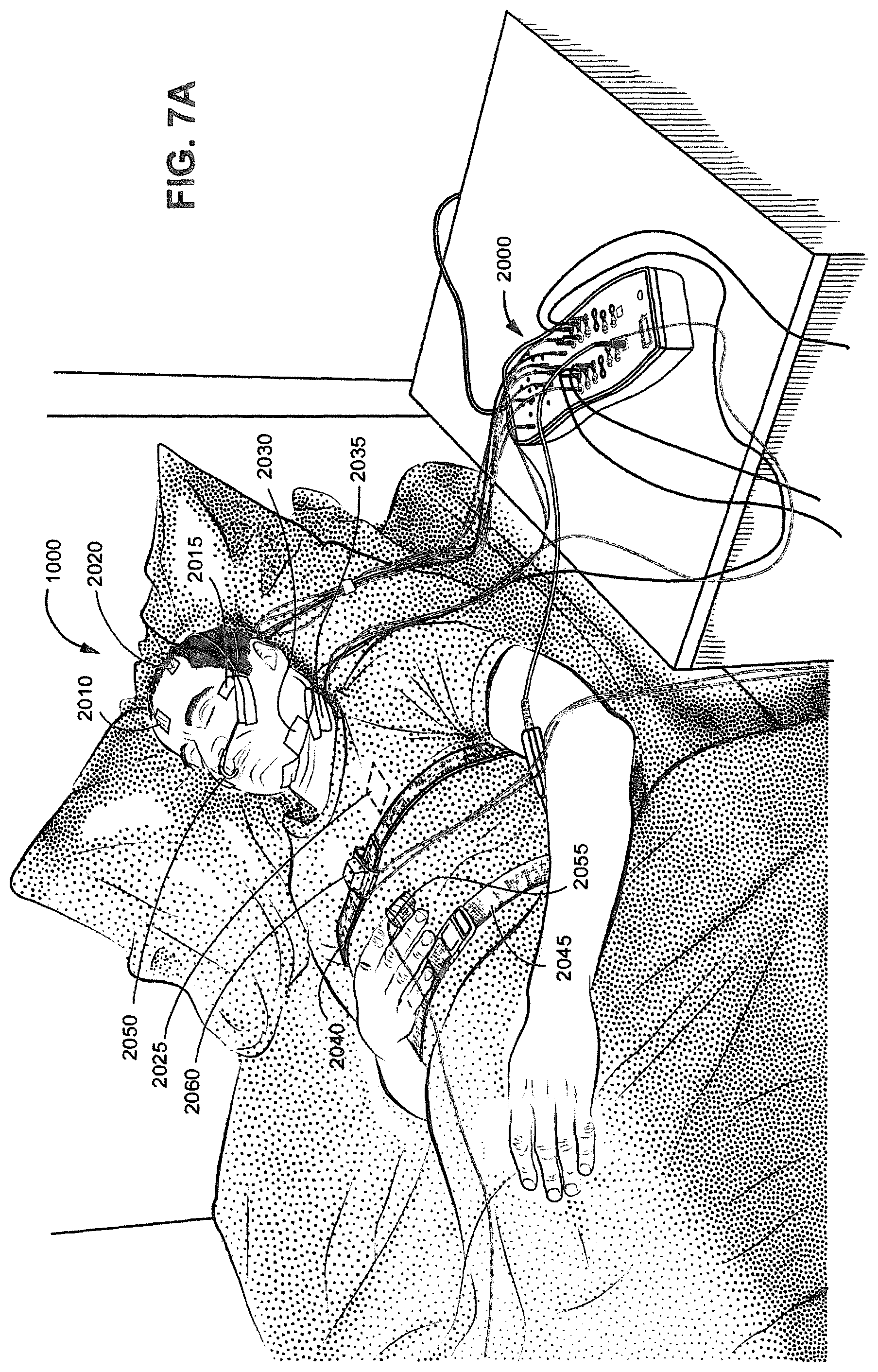 Patent US12350034 Figure 13 – Methods and apparatus for detection of disordered breathing
