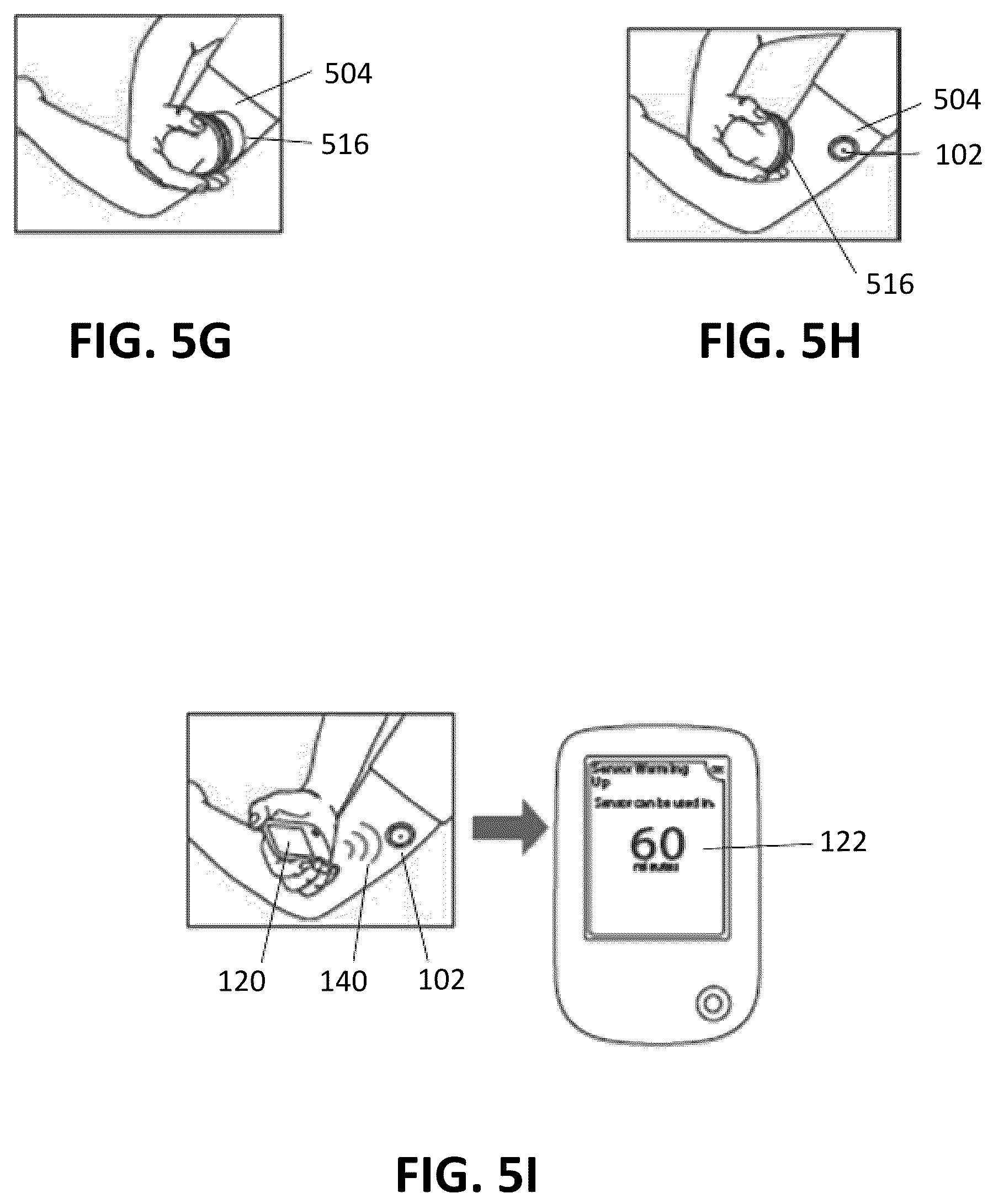 Patent US12350041 Figure 7 – Systems, devices, and methods for energy efficient electrical device activation