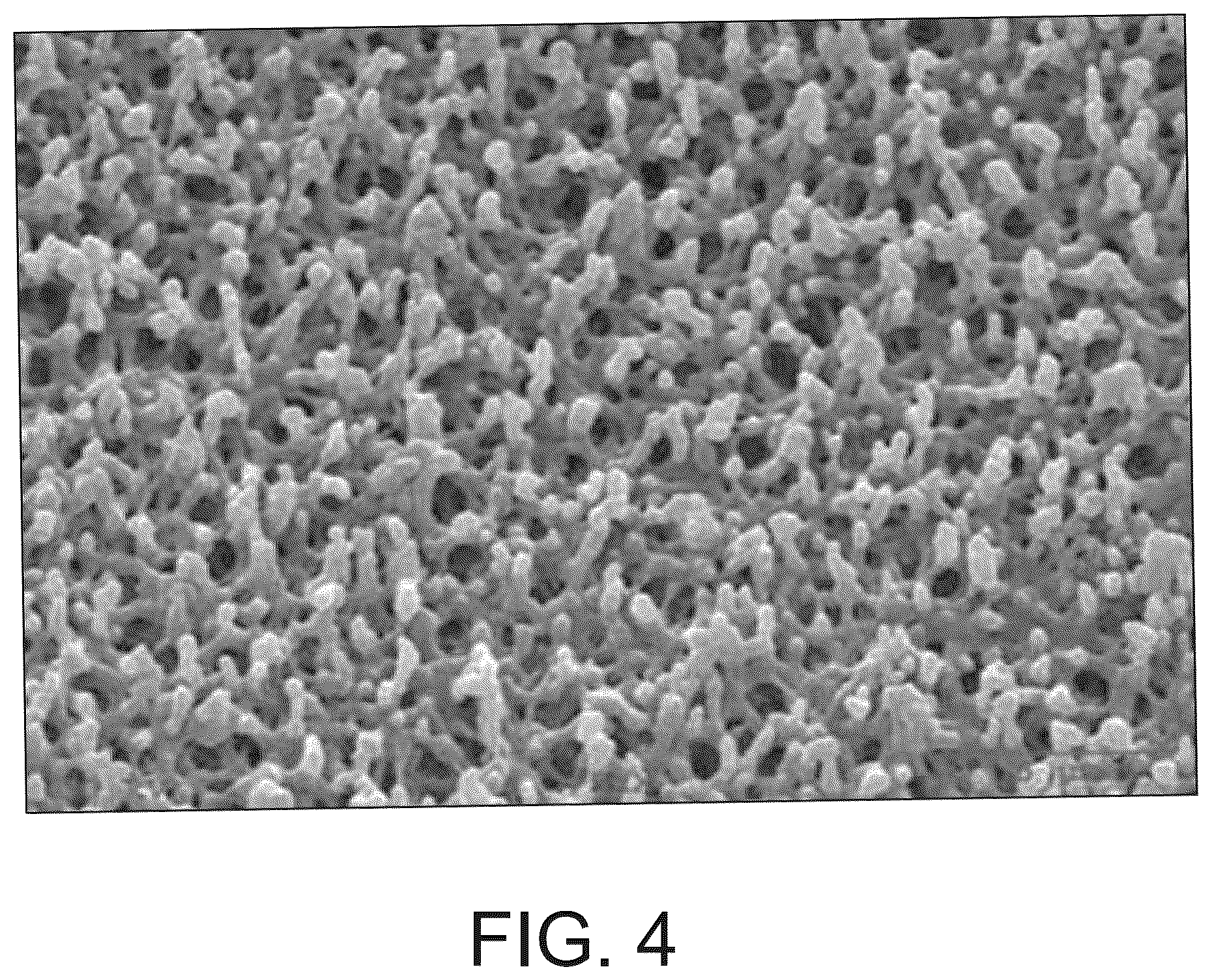 Patent US12350044 Figure 4 – Analyte monitoring systems and methods that make use of information about a condition of the environment surrounding an analyte sensor