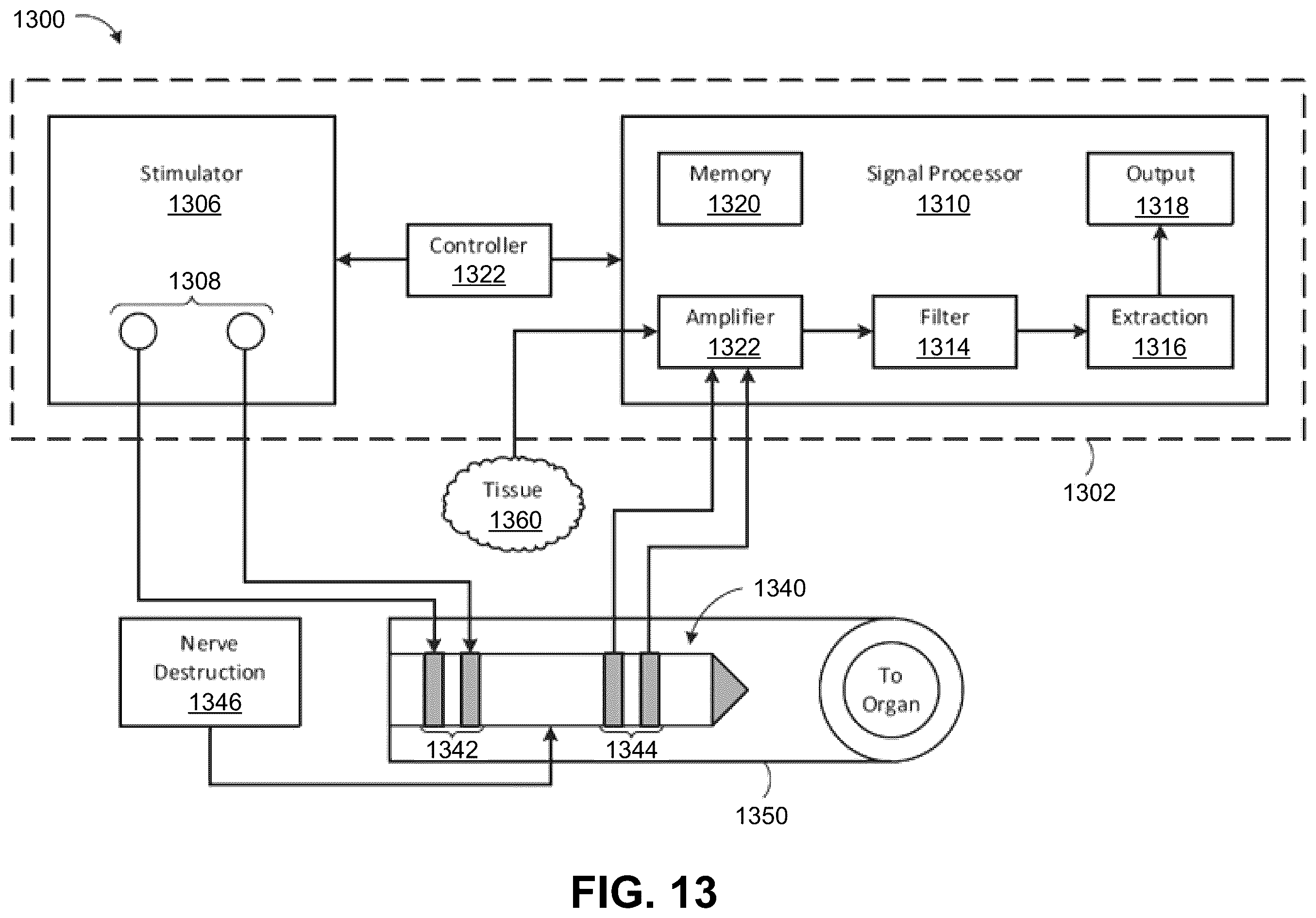 Patent US12350050 Figure 11 – Intraluminal microneurography probes and related systems and methods