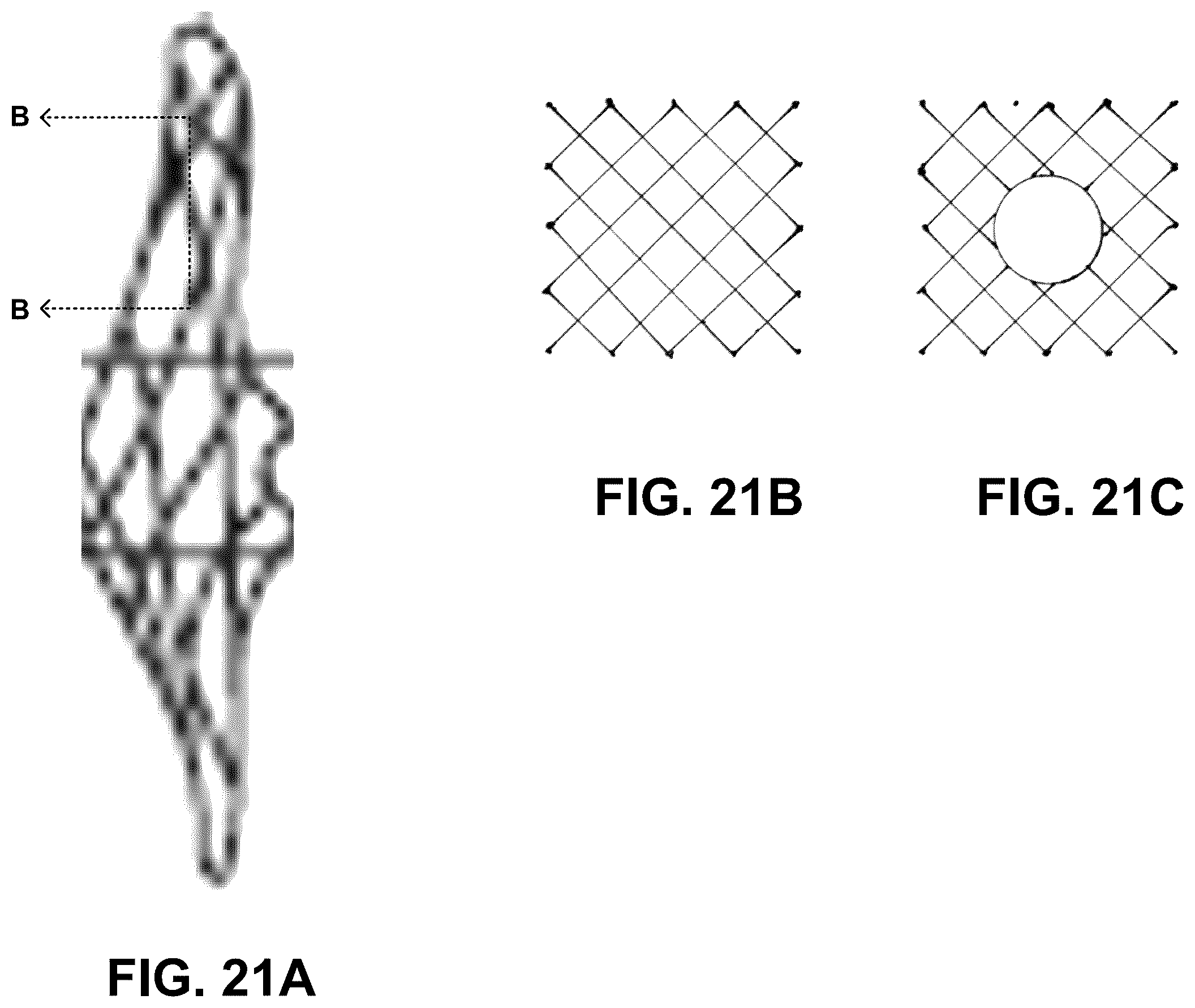 Patent US12350050 Figure 20 – Intraluminal microneurography probes and related systems and methods