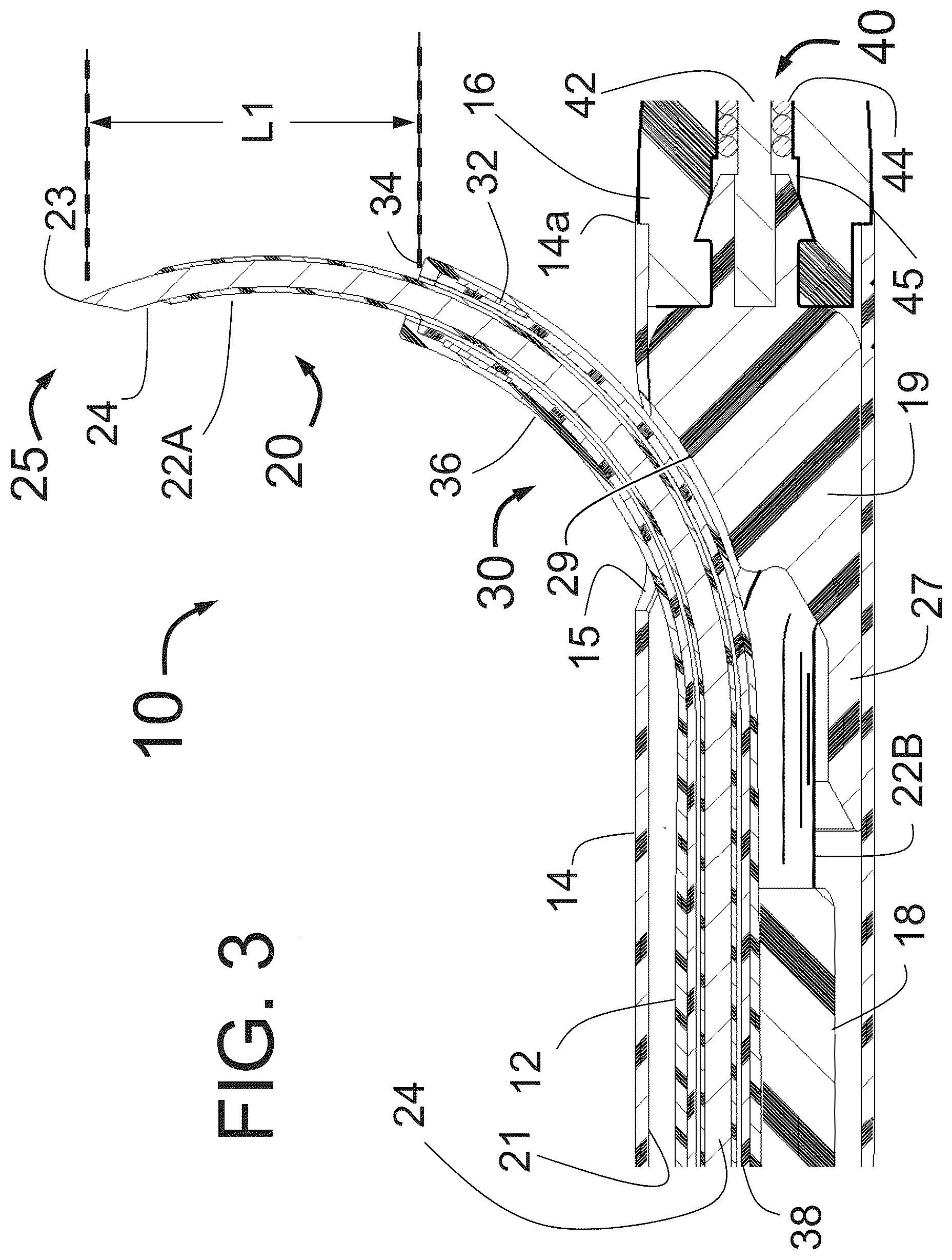 Patent US12350051 Figure 3 – Apparatus for effective ablation and nerve sensing associated with denervation