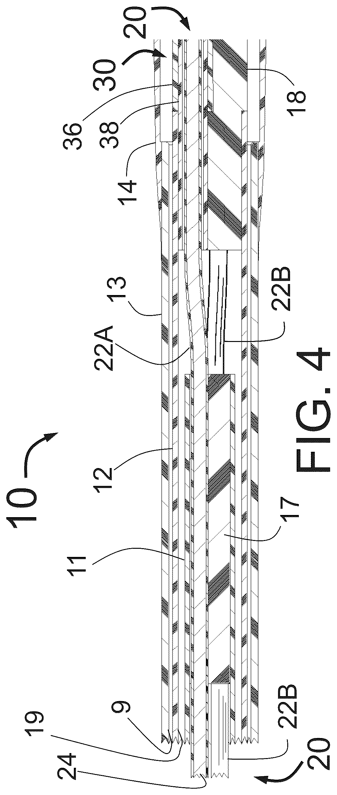 Patent US12350051 Figure 4 – Apparatus for effective ablation and nerve sensing associated with denervation