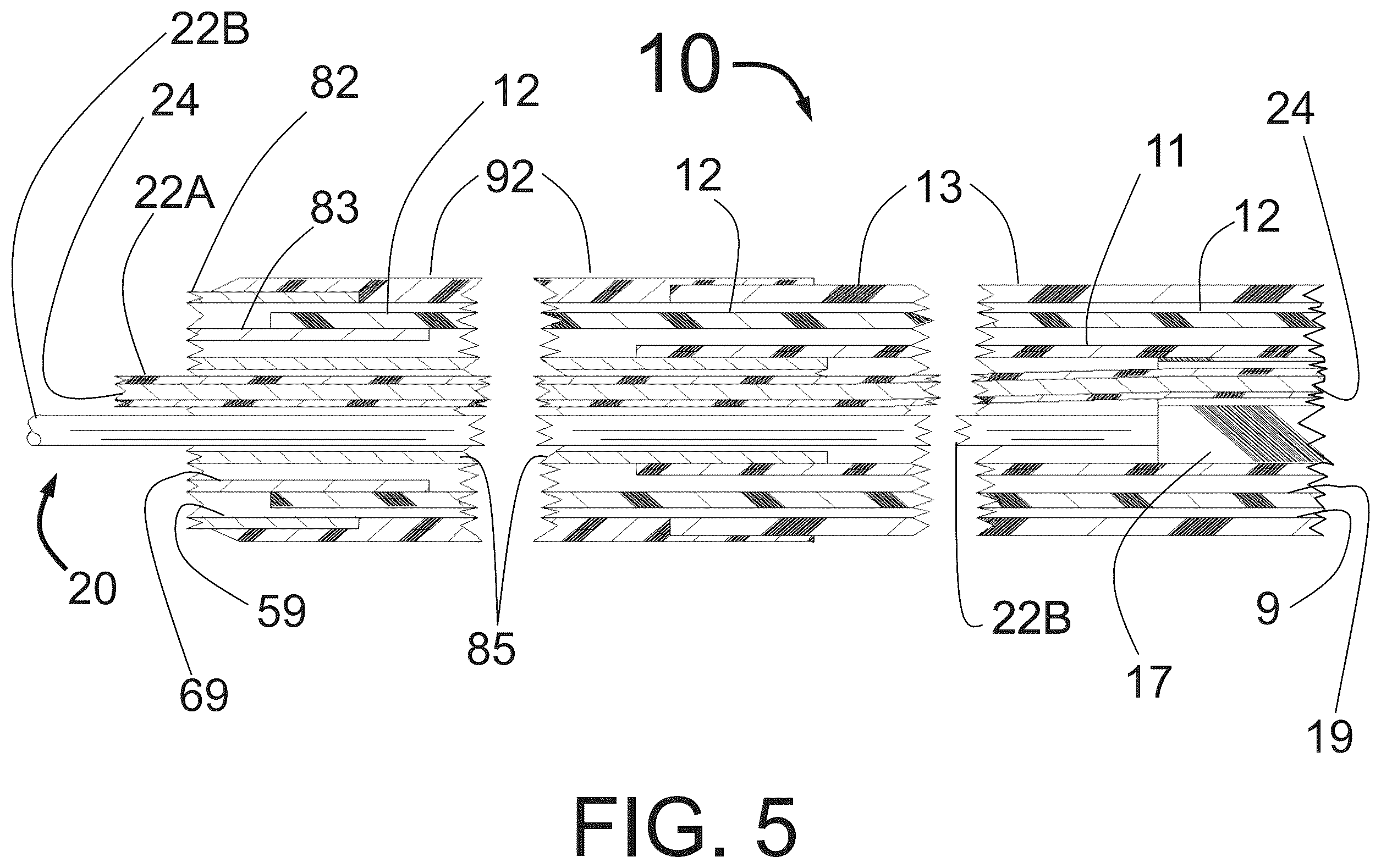 Patent US12350051 Figure 5 – Apparatus for effective ablation and nerve sensing associated with denervation