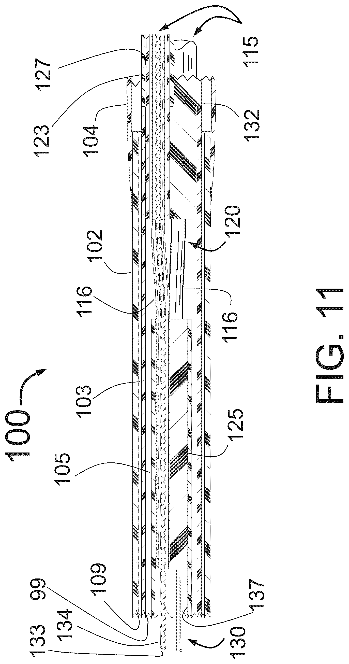 Patent US12350051 Figure 10 – Apparatus for effective ablation and nerve sensing associated with denervation
