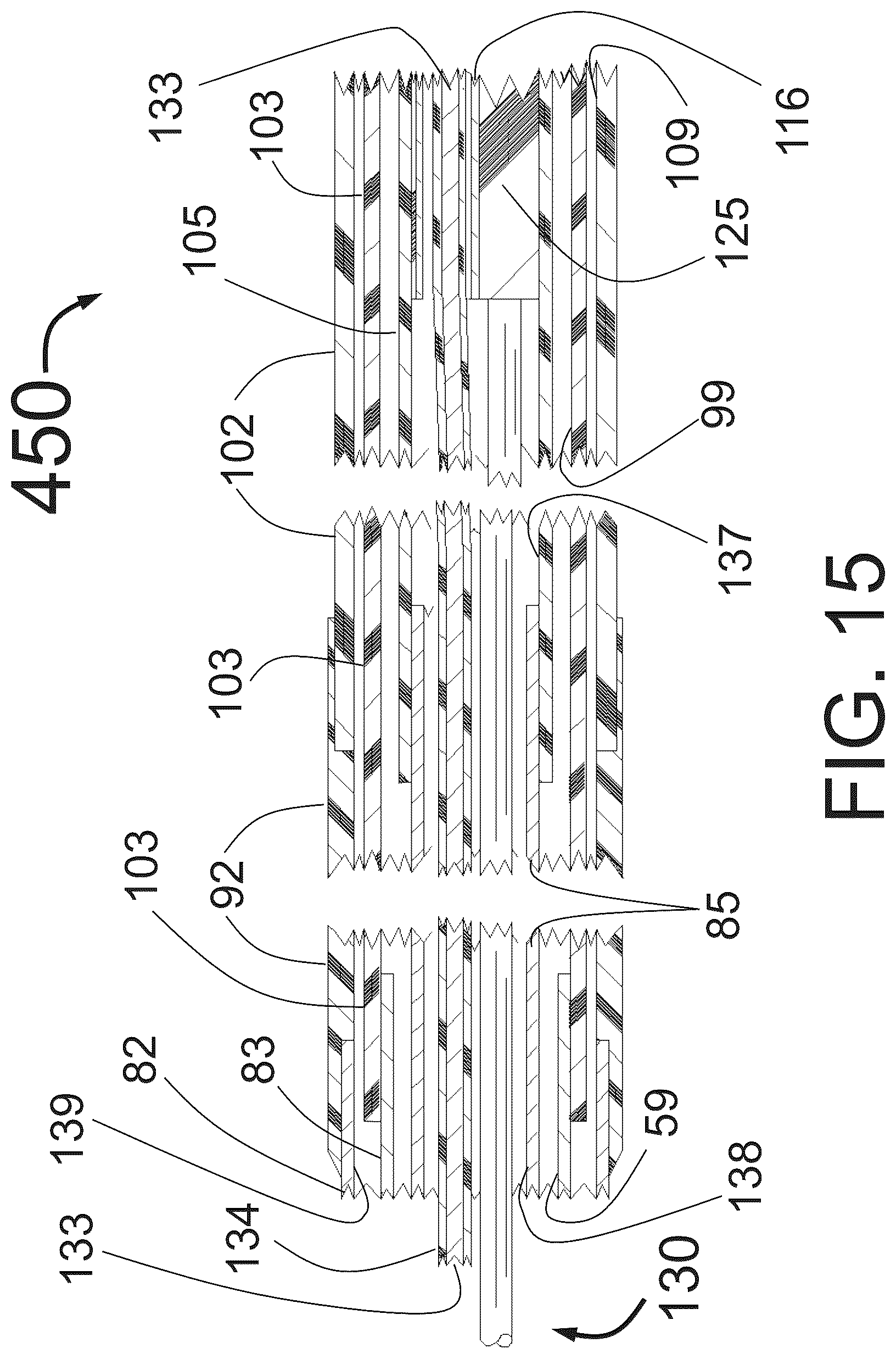 Patent US12350051 Figure 13 – Apparatus for effective ablation and nerve sensing associated with denervation