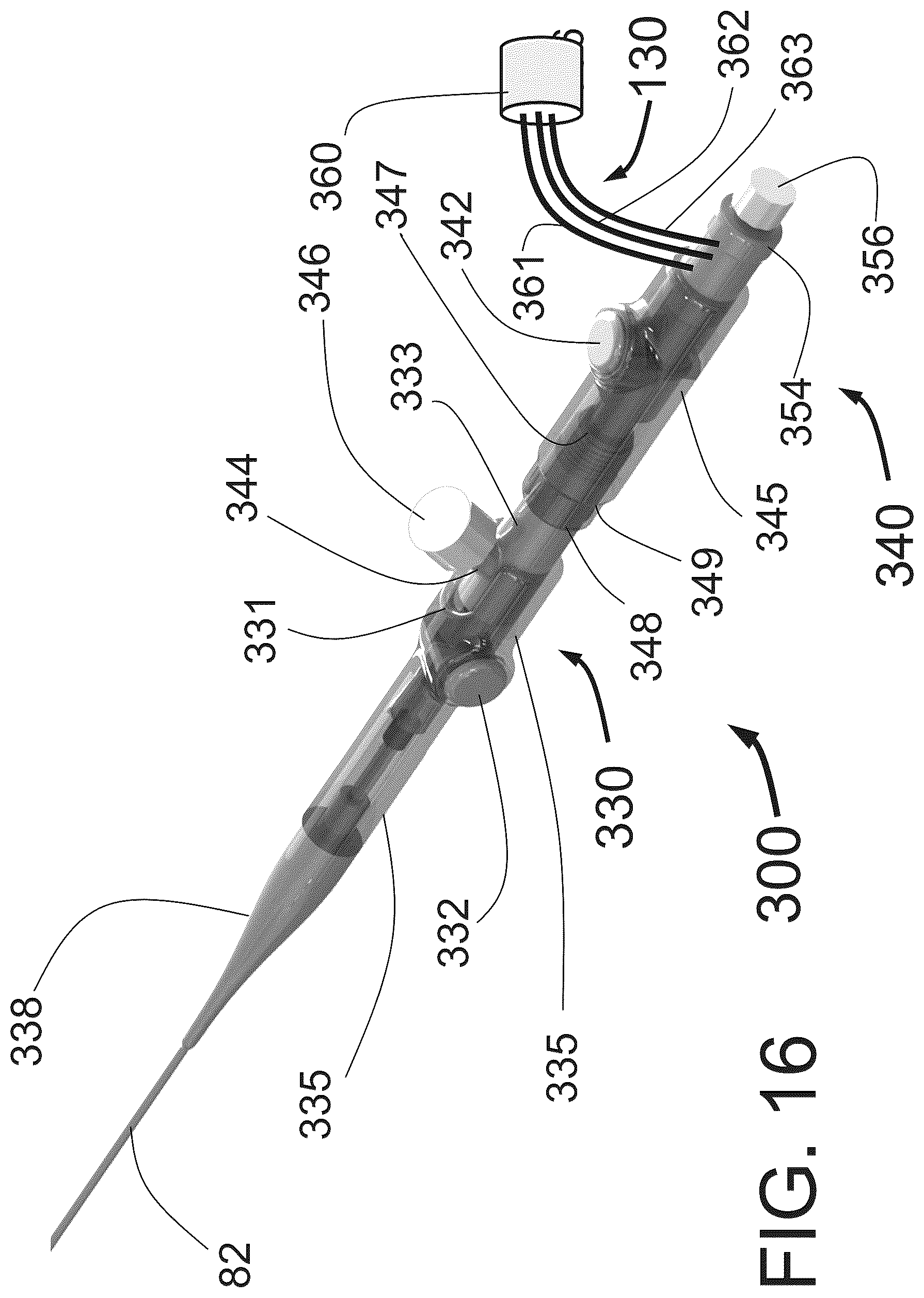Patent US12350051 Figure 14 – Apparatus for effective ablation and nerve sensing associated with denervation