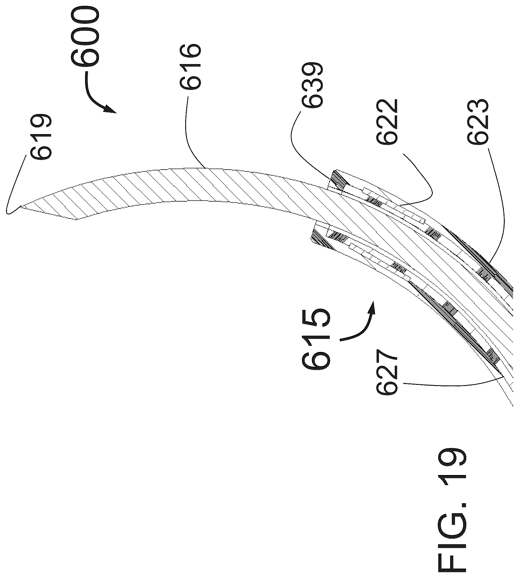 Patent US12350051 Figure 17 – Apparatus for effective ablation and nerve sensing associated with denervation