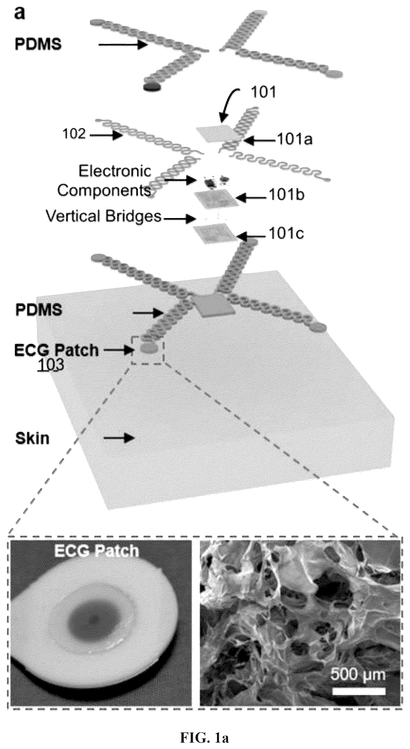 Patent US12350054 Figure 1 – Stretchable and wearable wireless 3-leads ECG monitoring apparatus