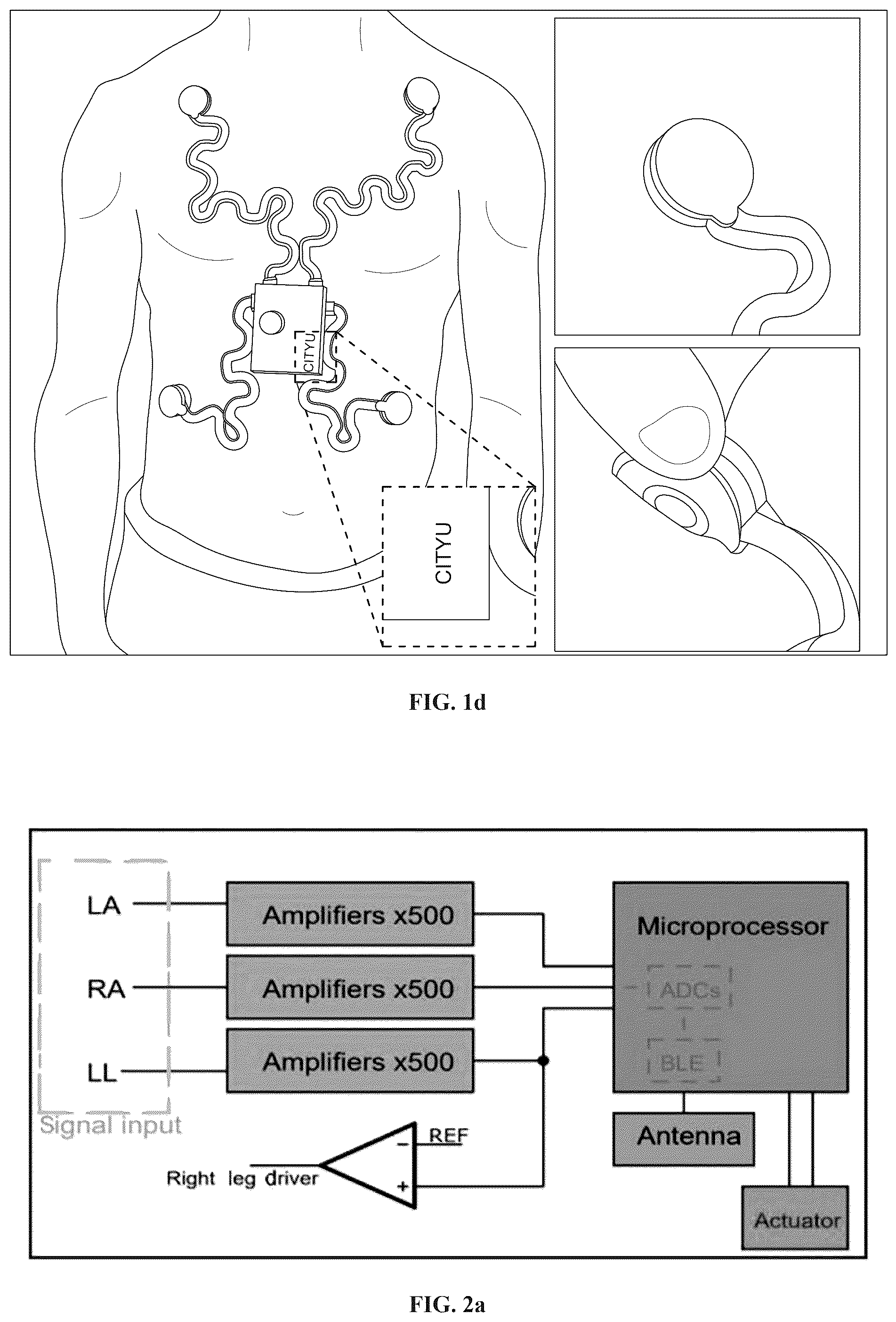 Patent US12350054 Figure 4 – Stretchable and wearable wireless 3-leads ECG monitoring apparatus