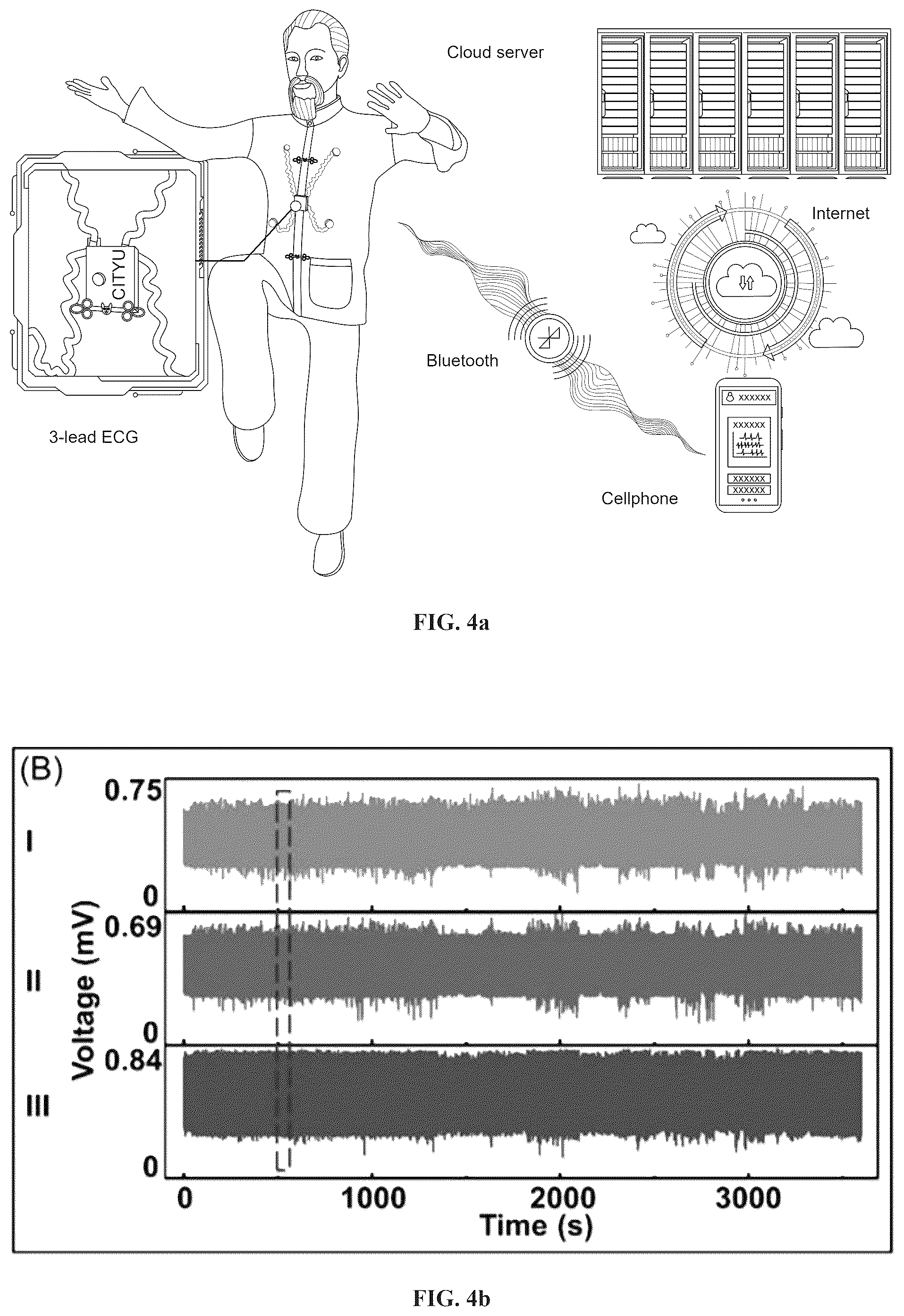 Patent US12350054 Figure 10 – Stretchable and wearable wireless 3-leads ECG monitoring apparatus