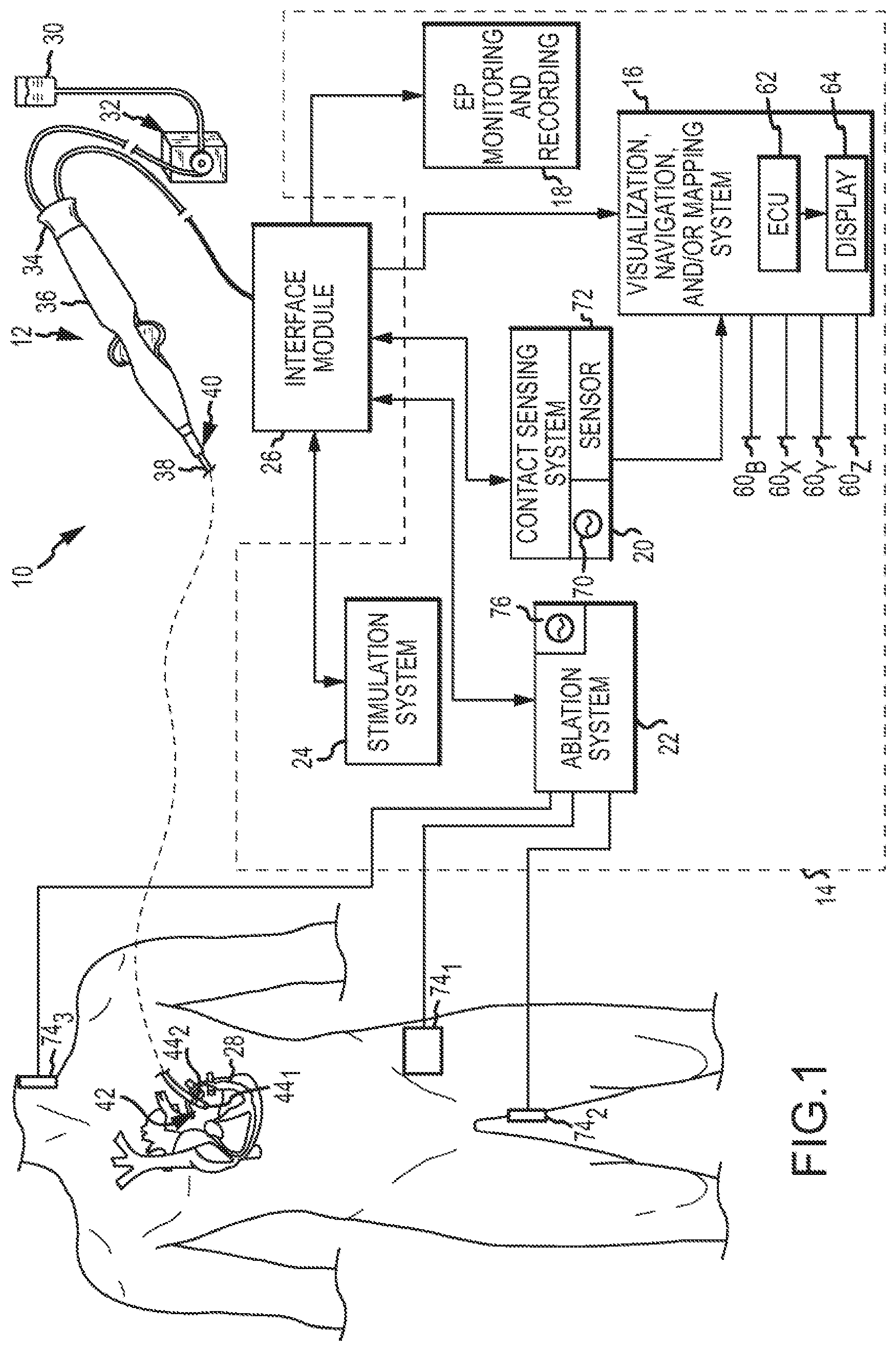 Patent US12350055 Figure 1 – Electrophysiology laboratory system for use with magnetic resonance imaging systems