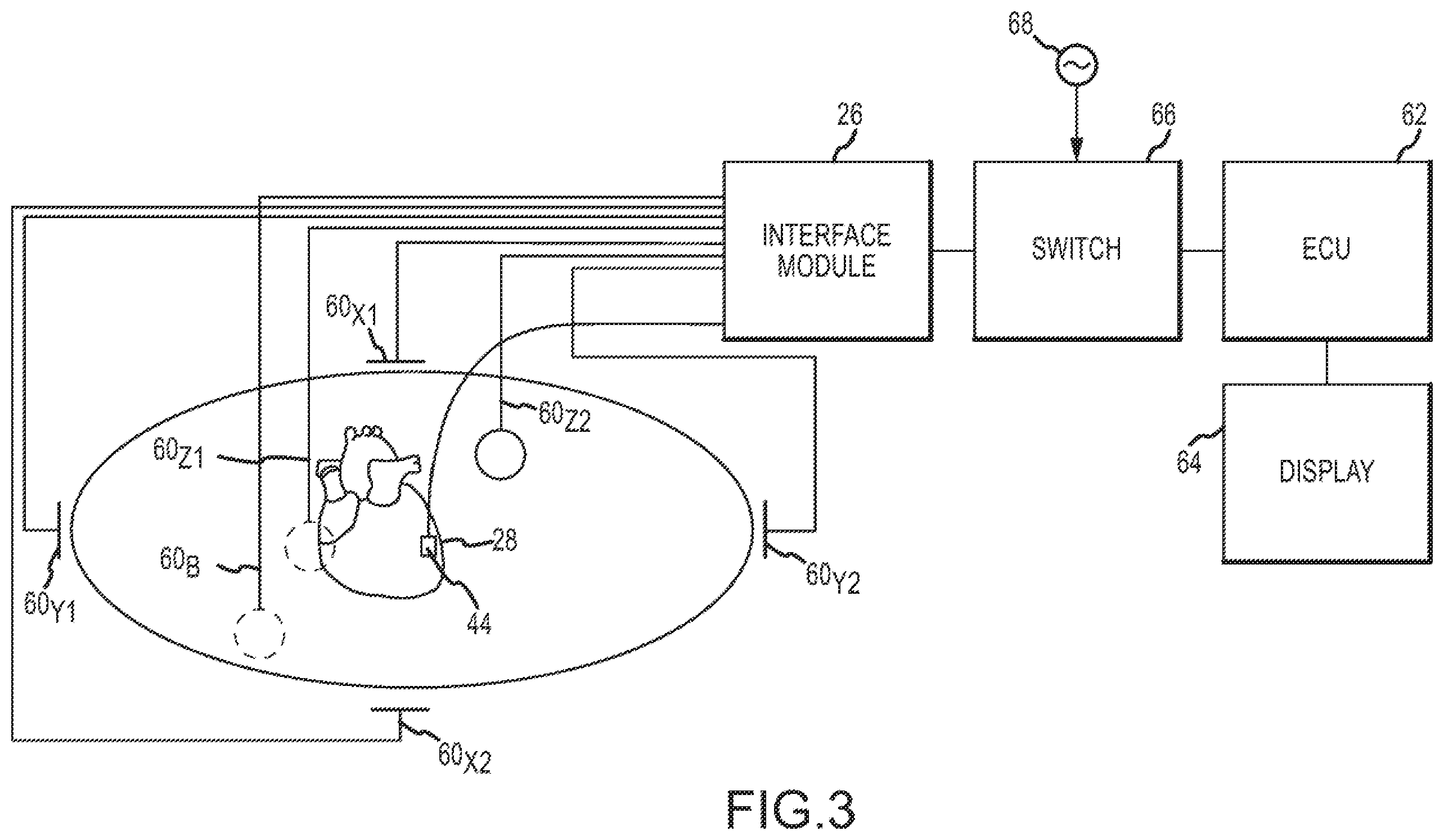 Patent US12350055 Figure 3 – Electrophysiology laboratory system for use with magnetic resonance imaging systems