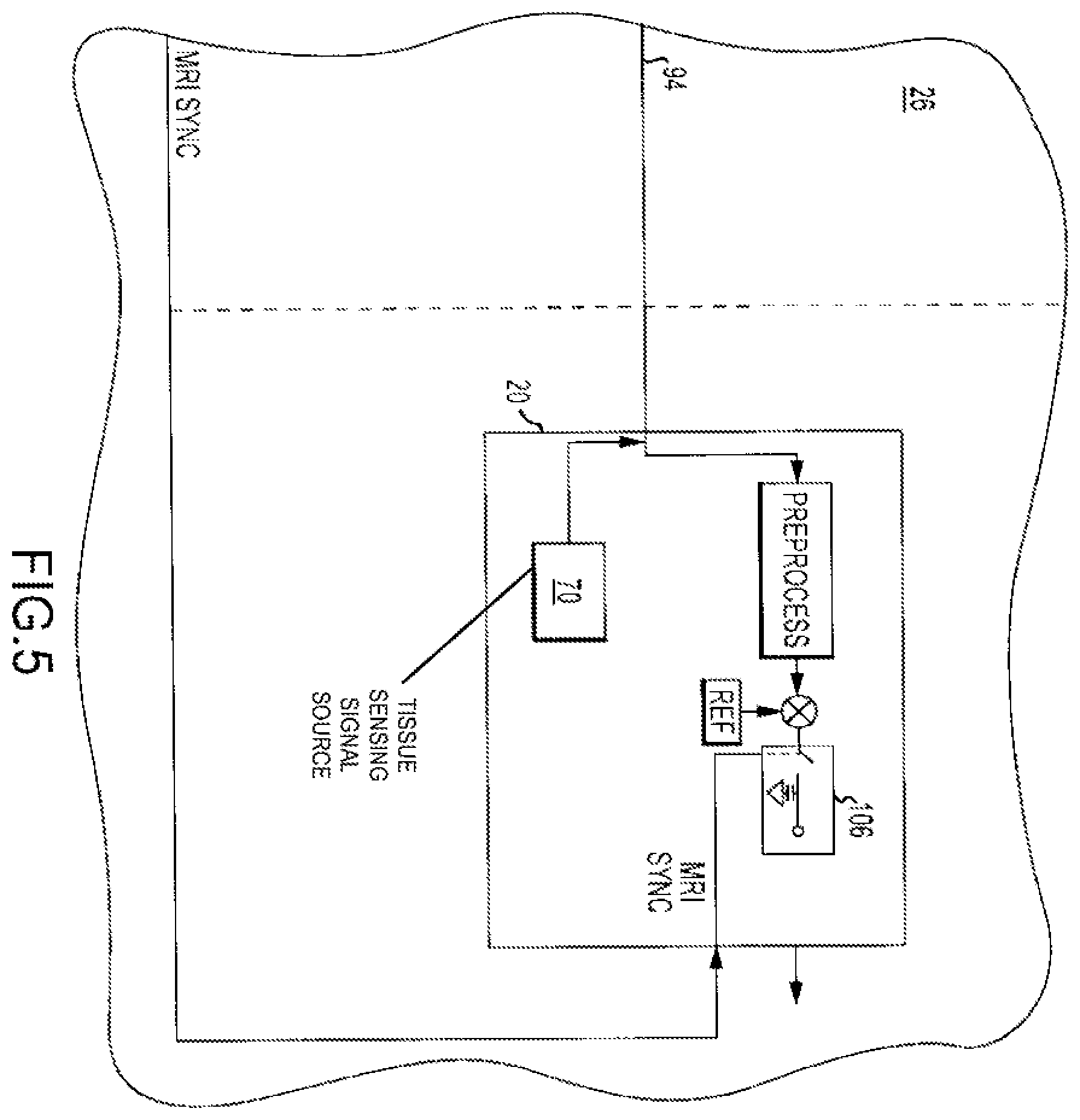 Patent US12350055 Figure 5 – Electrophysiology laboratory system for use with magnetic resonance imaging systems