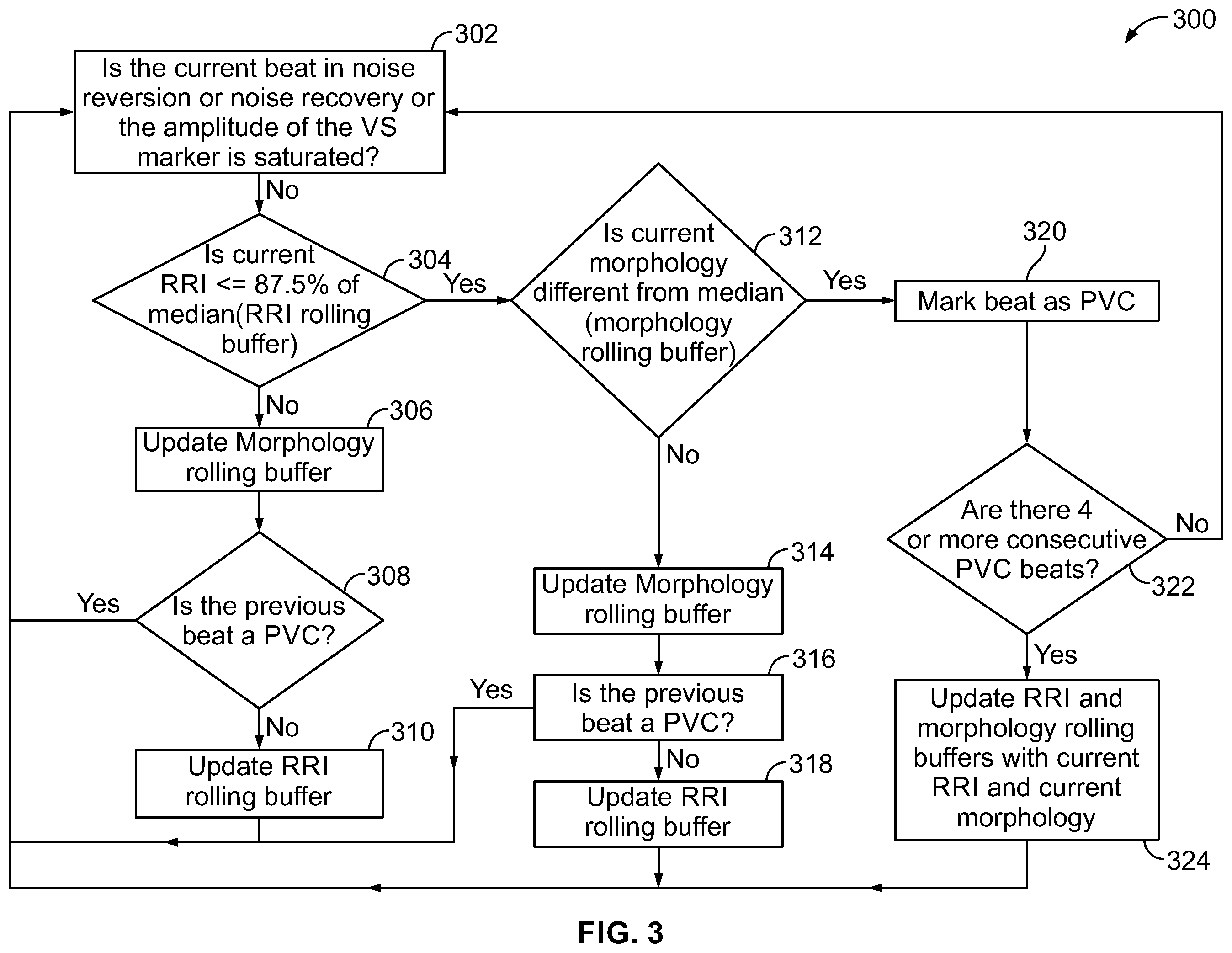 Patent US12350058 Figure 3 – System for identifying premature ventricular contractions