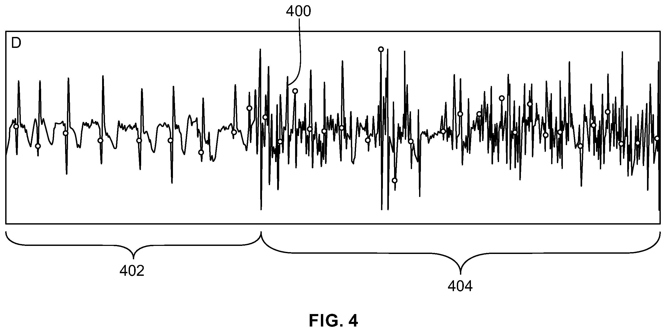 Patent US12350058 Figure 4 – System for identifying premature ventricular contractions