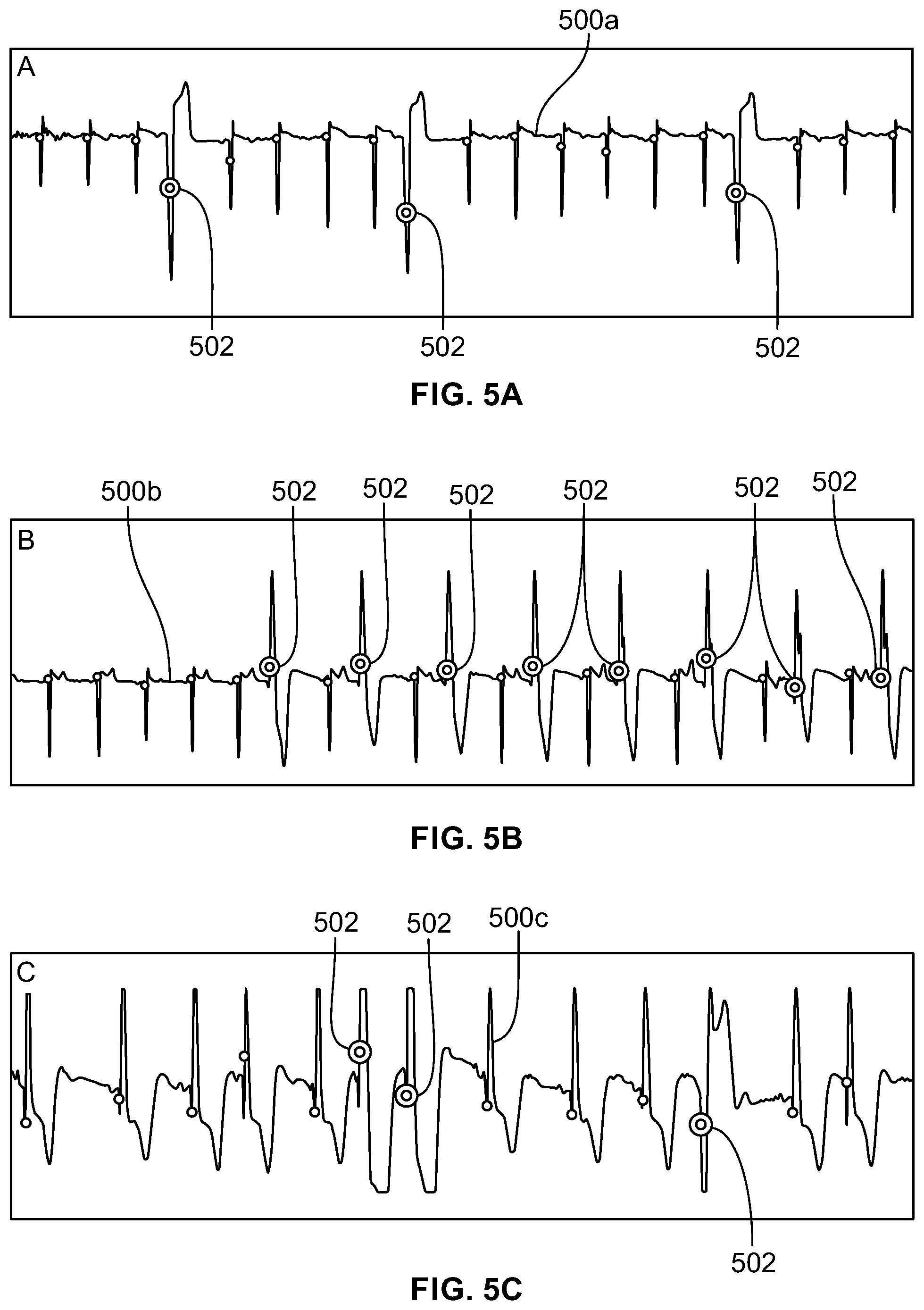 Patent US12350058 Figure 5 – System for identifying premature ventricular contractions