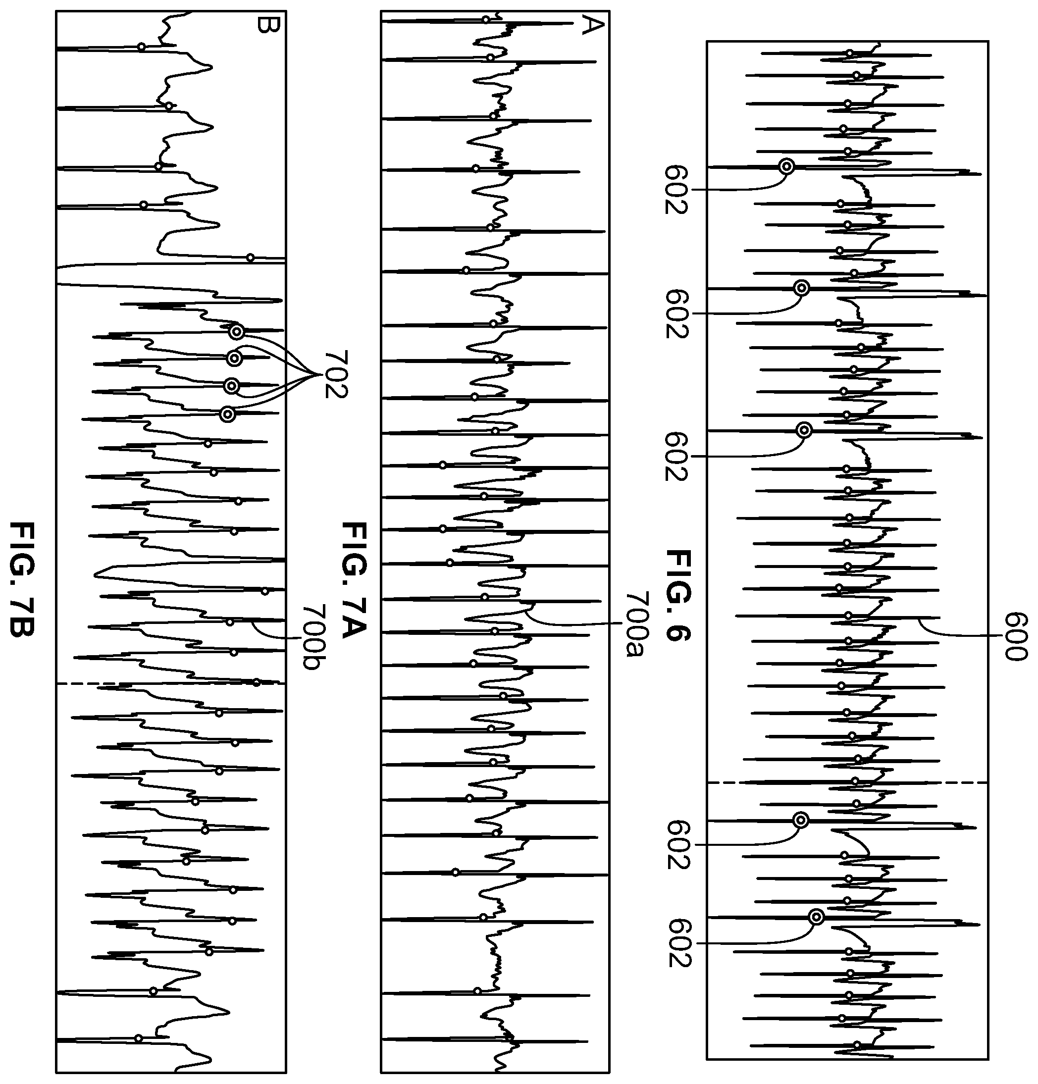Patent US12350058 Figure 6 – System for identifying premature ventricular contractions