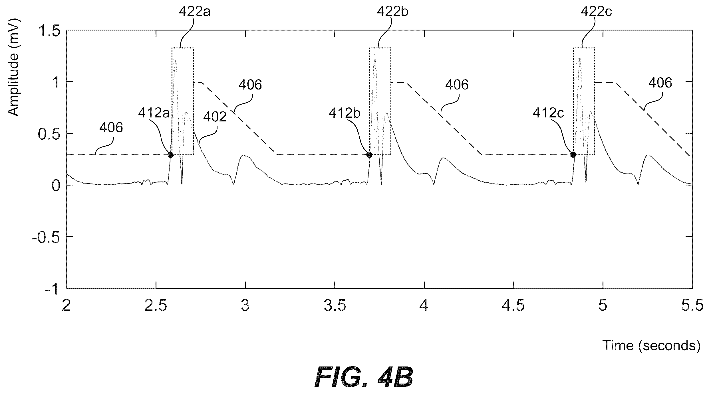 Patent US12350059 Figure 4 – Robust ventricular sensing of far-field EGM or ECG signals that avoids oversensing of ventricular sensed events