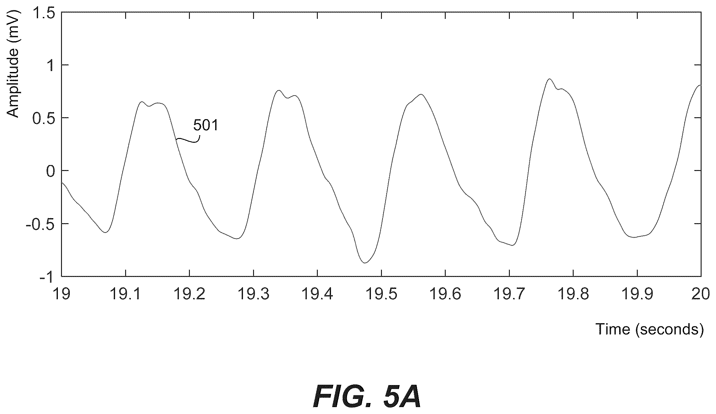 Patent US12350059 Figure 5 – Robust ventricular sensing of far-field EGM or ECG signals that avoids oversensing of ventricular sensed events