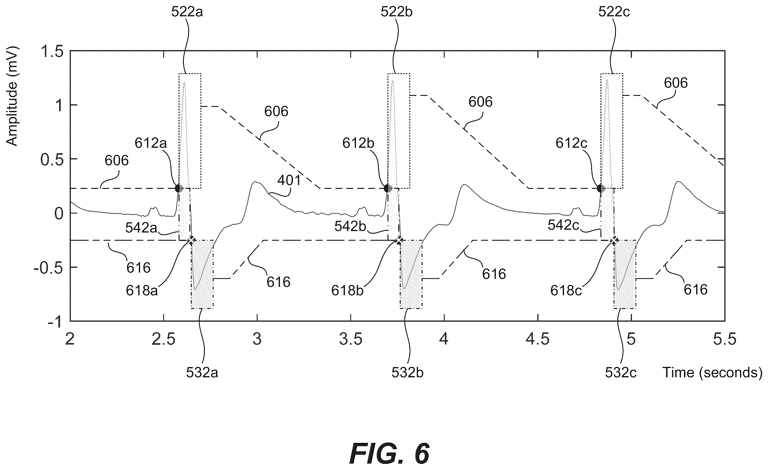 Patent US12350059 Figure 7 – Robust ventricular sensing of far-field EGM or ECG signals that avoids oversensing of ventricular sensed events