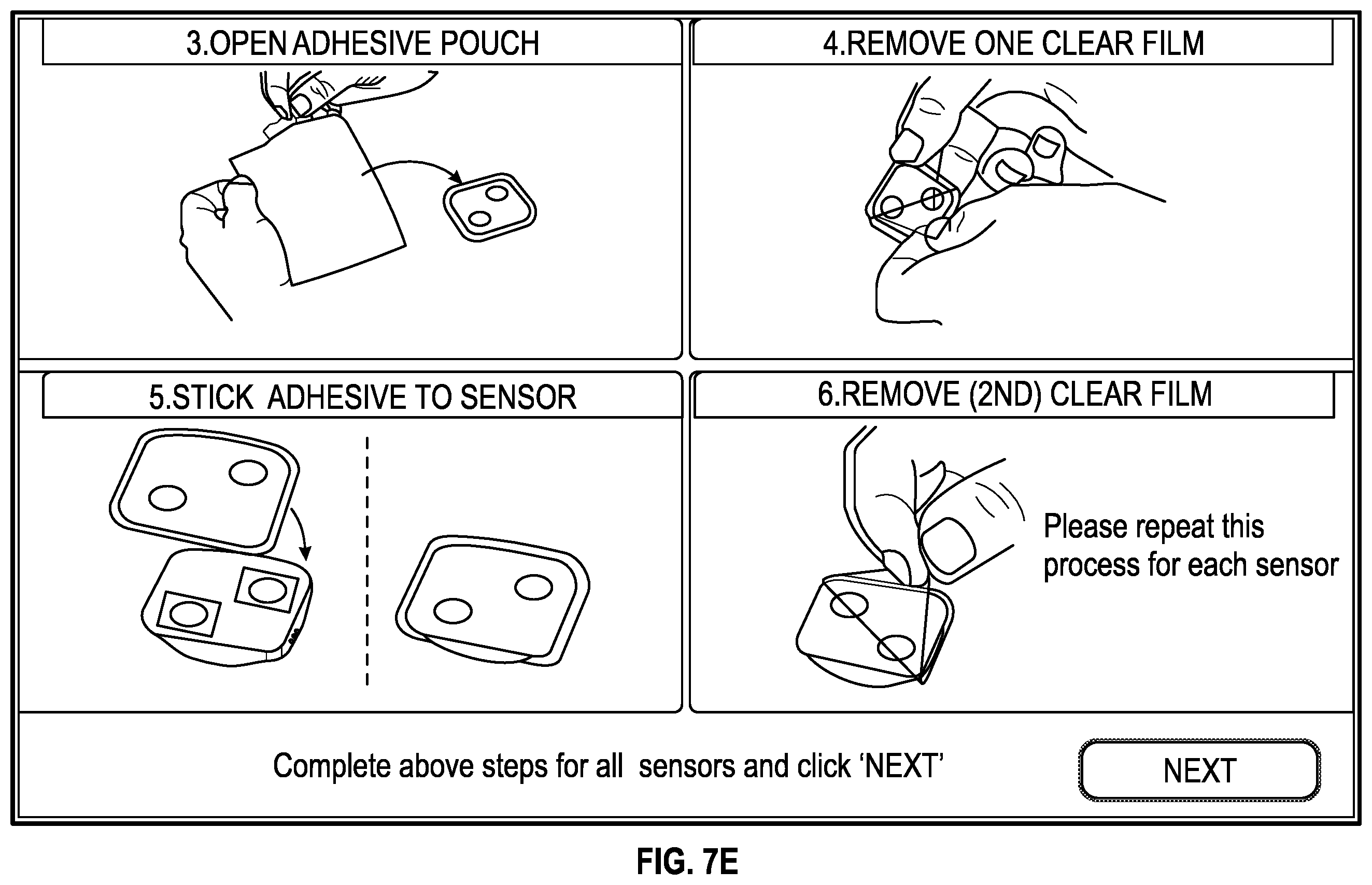 Patent US12350061 Figure 16 – Systems and methods for electroencephalogram monitoring