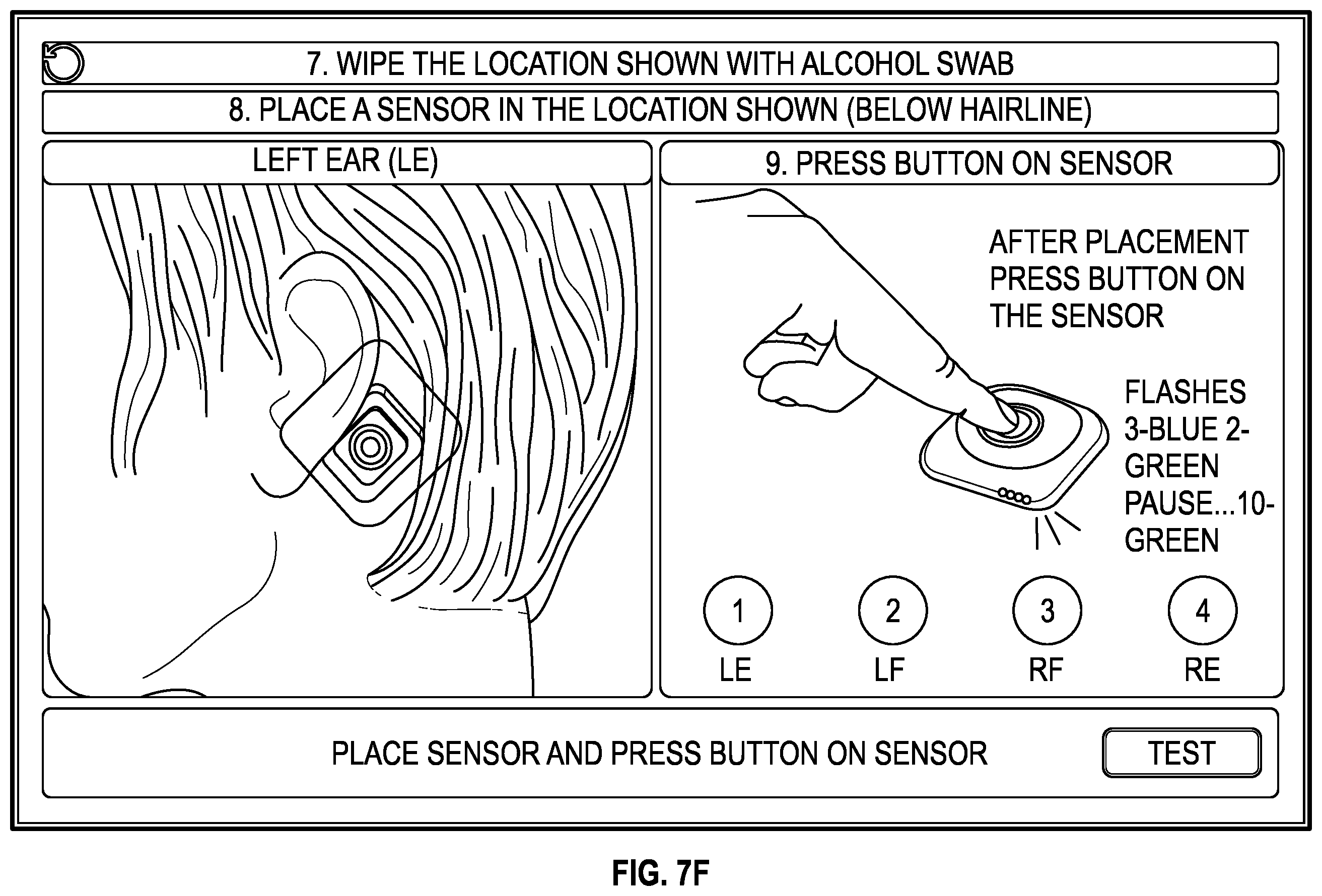 Patent US12350061 Figure 17 – Systems and methods for electroencephalogram monitoring