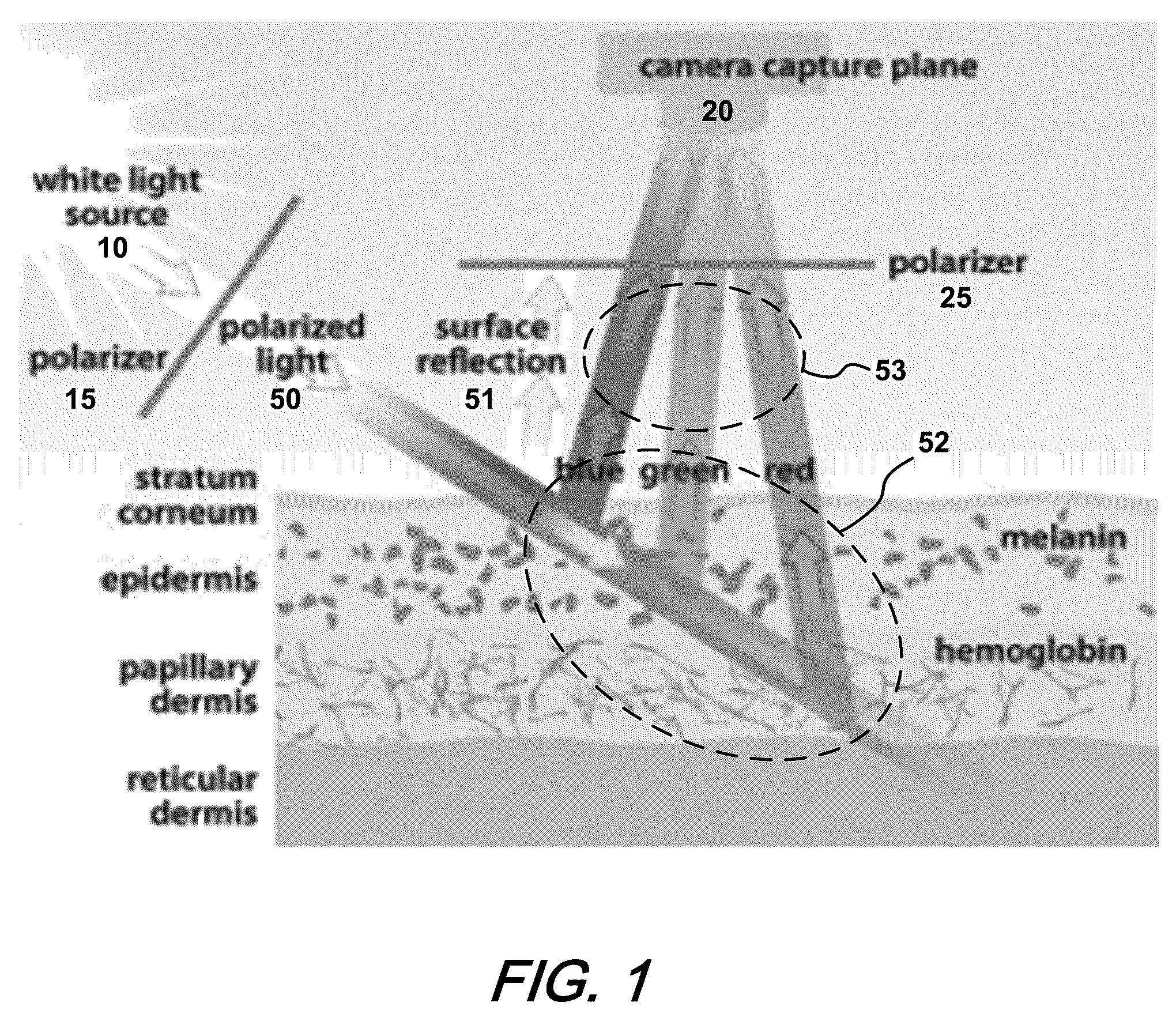 Patent US12350063 Figure 1 – Enhancing pigmentation in dermoscopy images