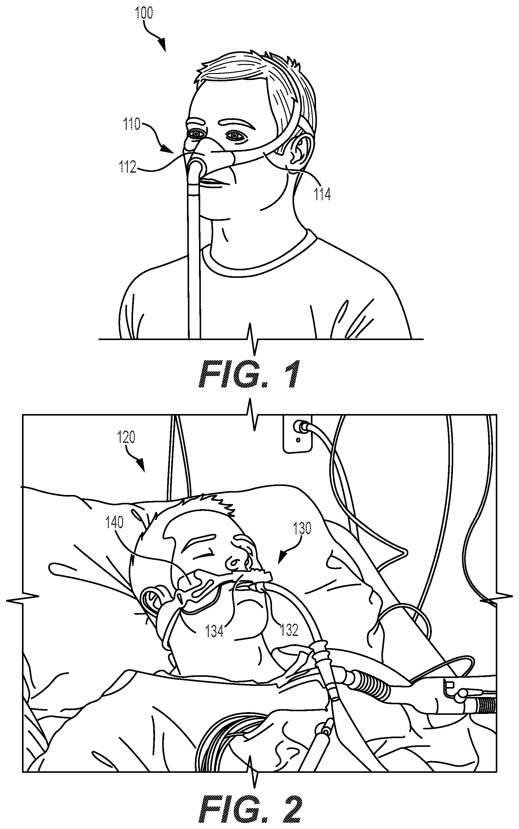 Patent US12350064 Figure 1 – Detection of tissue damage