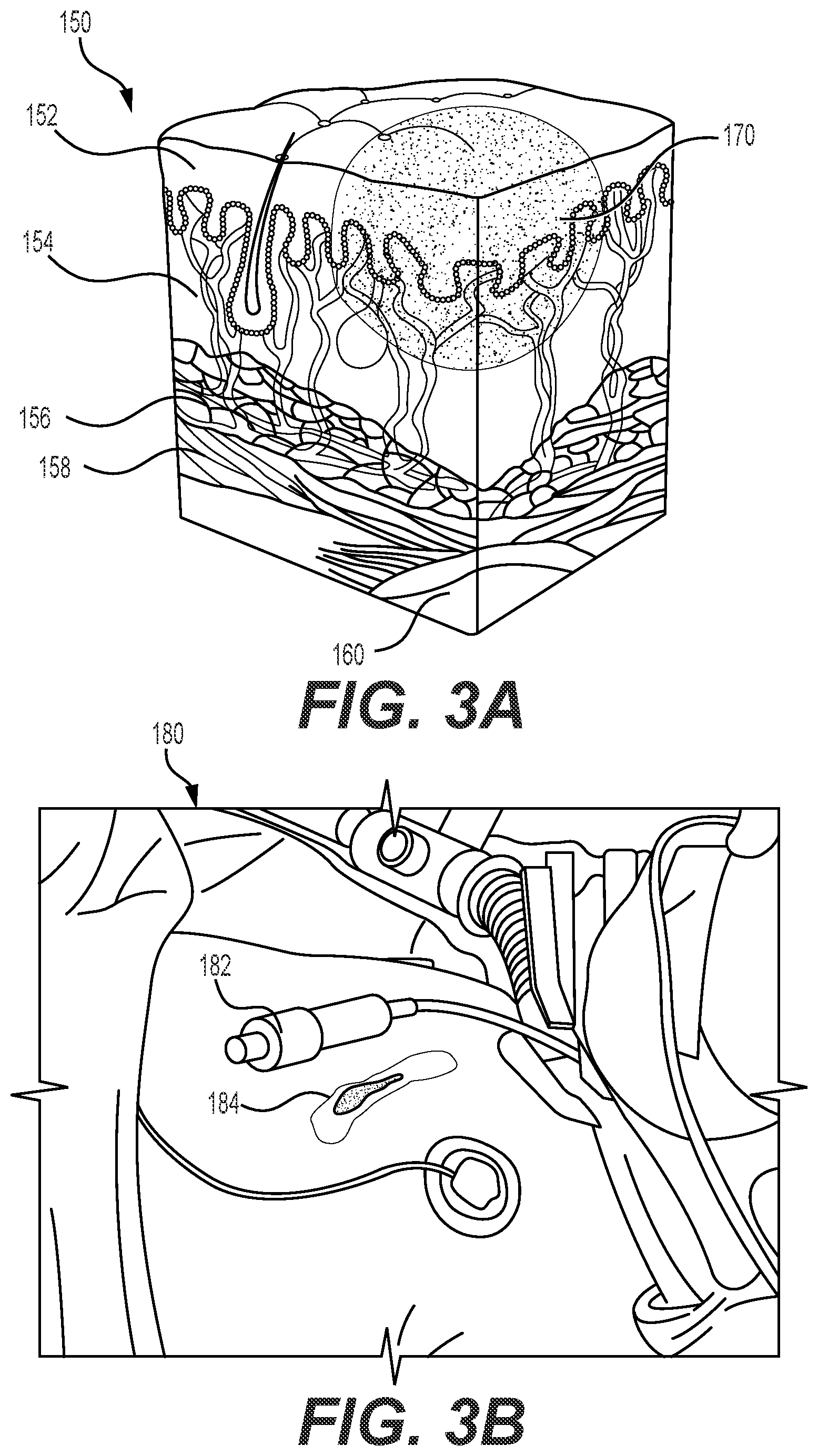 Patent US12350064 Figure 2 – Detection of tissue damage