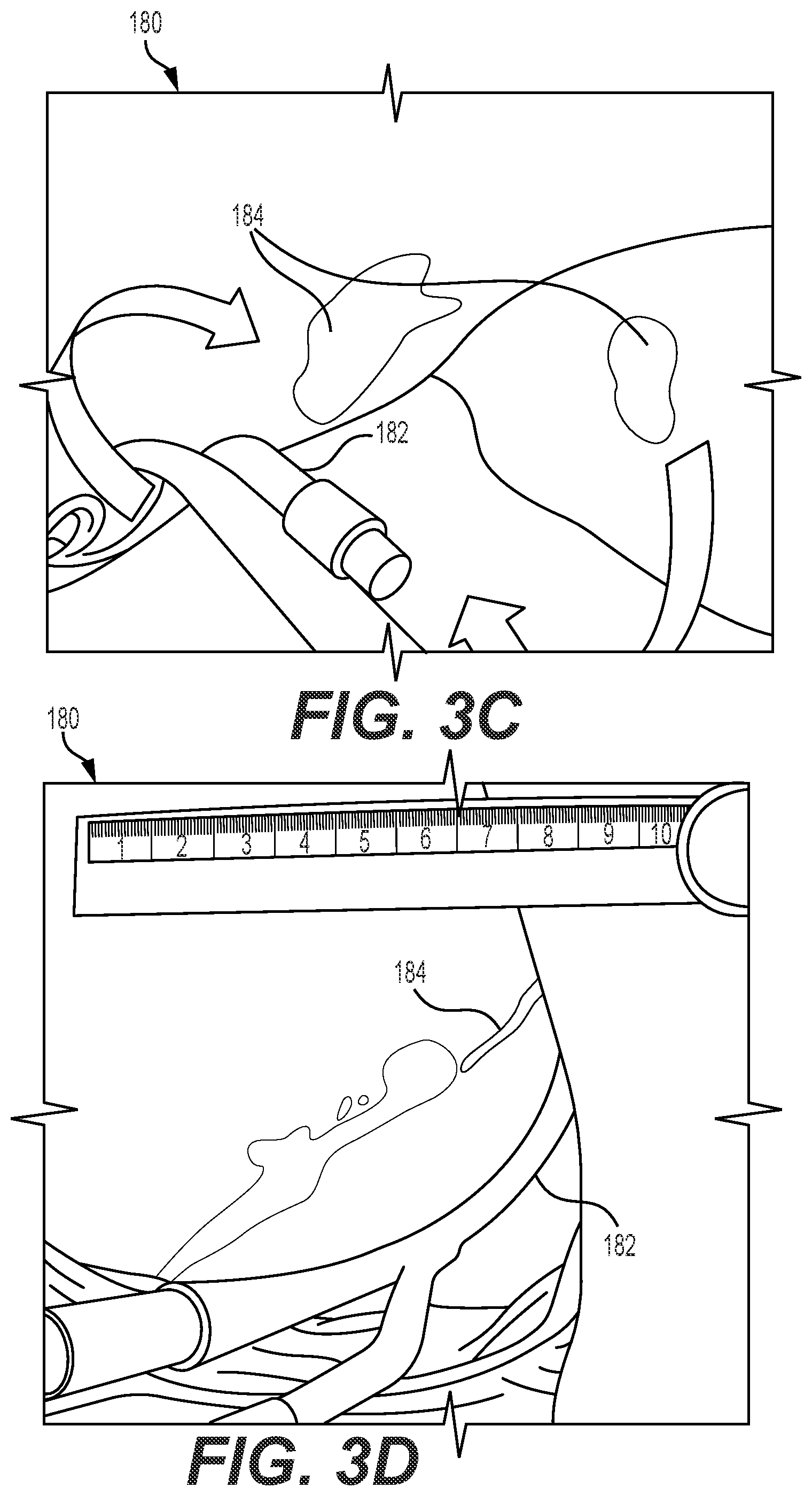 Patent US12350064 Figure 3 – Detection of tissue damage