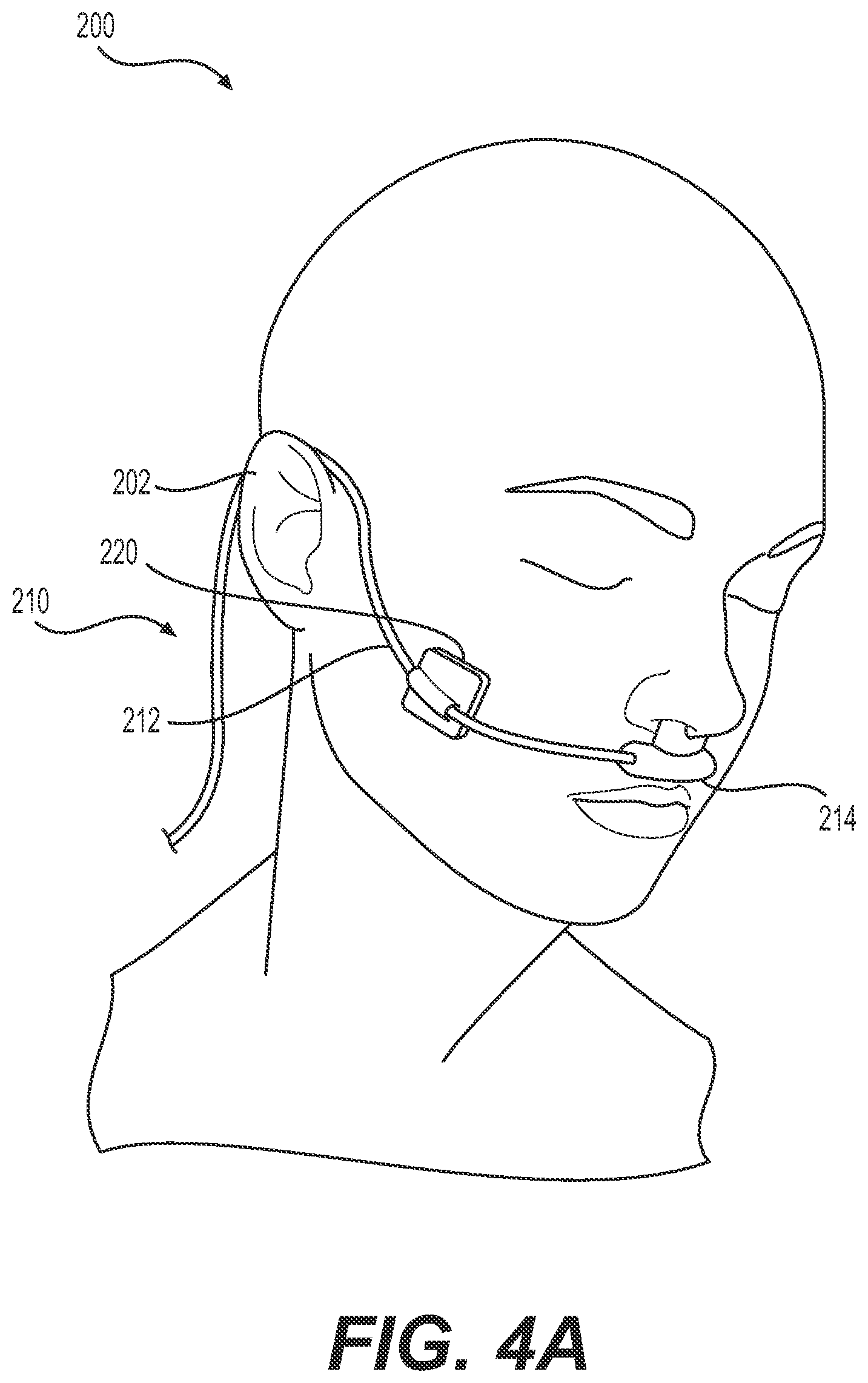 Patent US12350064 Figure 4 – Detection of tissue damage