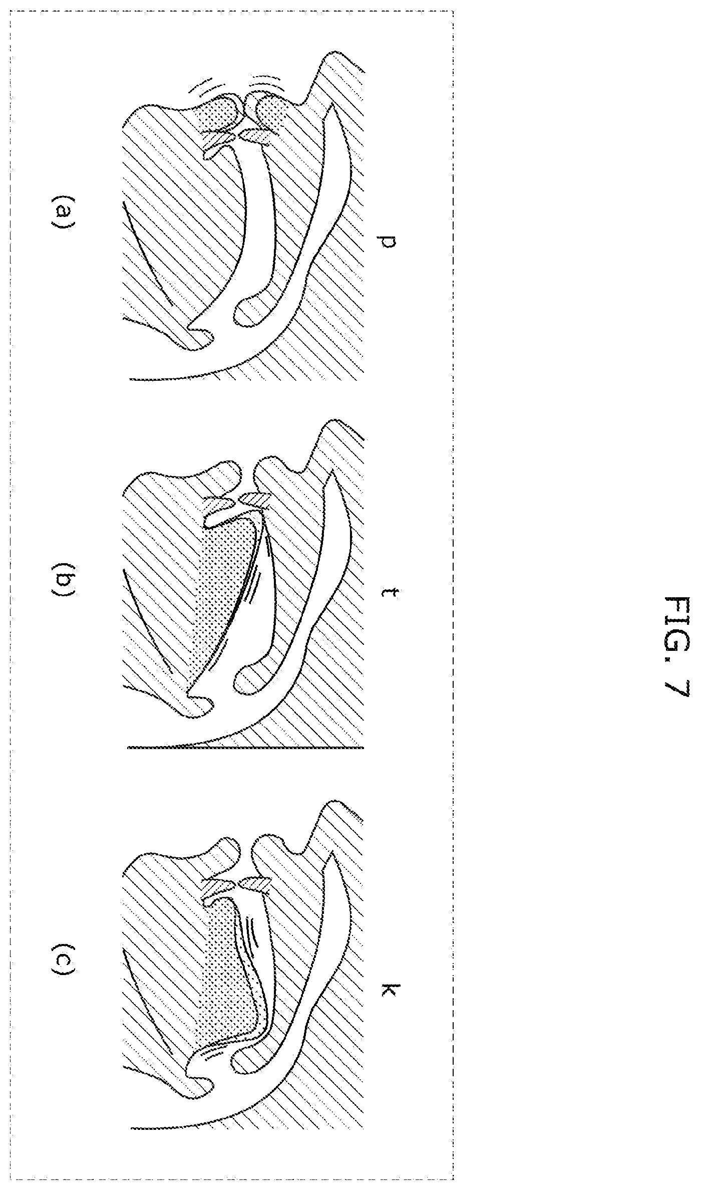 Patent US12350065 Figure 7 – Oral function visualization system, oral function visualization method, and recording medium