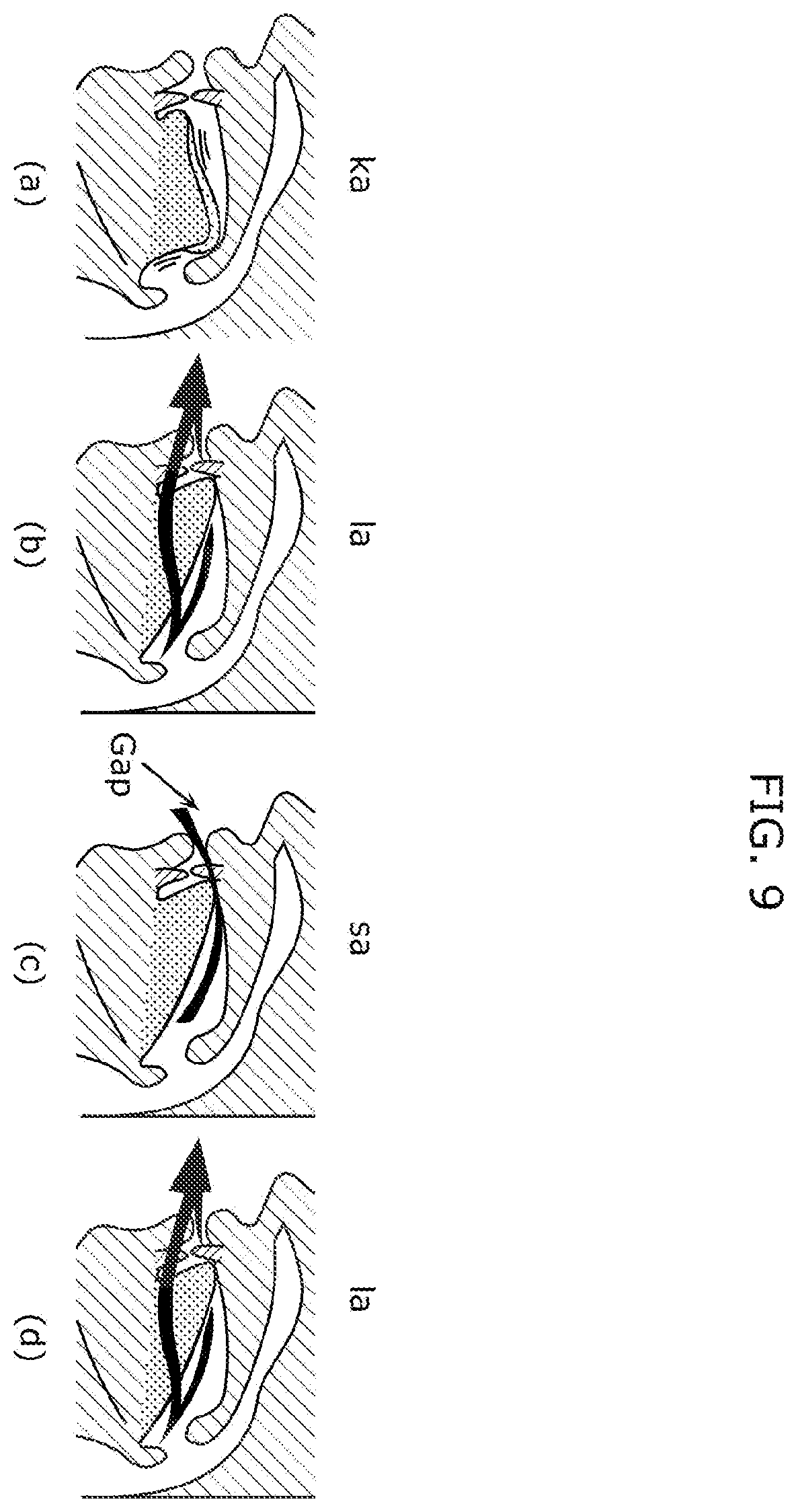 Patent US12350065 Figure 9 – Oral function visualization system, oral function visualization method, and recording medium