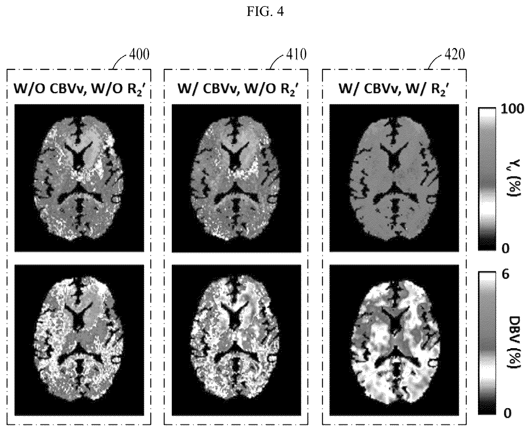 Patent US12350068 Figure 4 – Magnetic resonance imaging device and method for precisely measuring cerebral oxygen metabolism