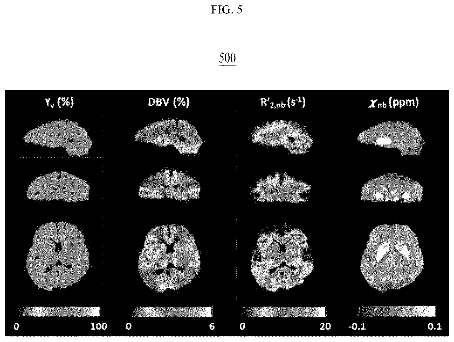 Patent US12350068 Figure 5 – Magnetic resonance imaging device and method for precisely measuring cerebral oxygen metabolism