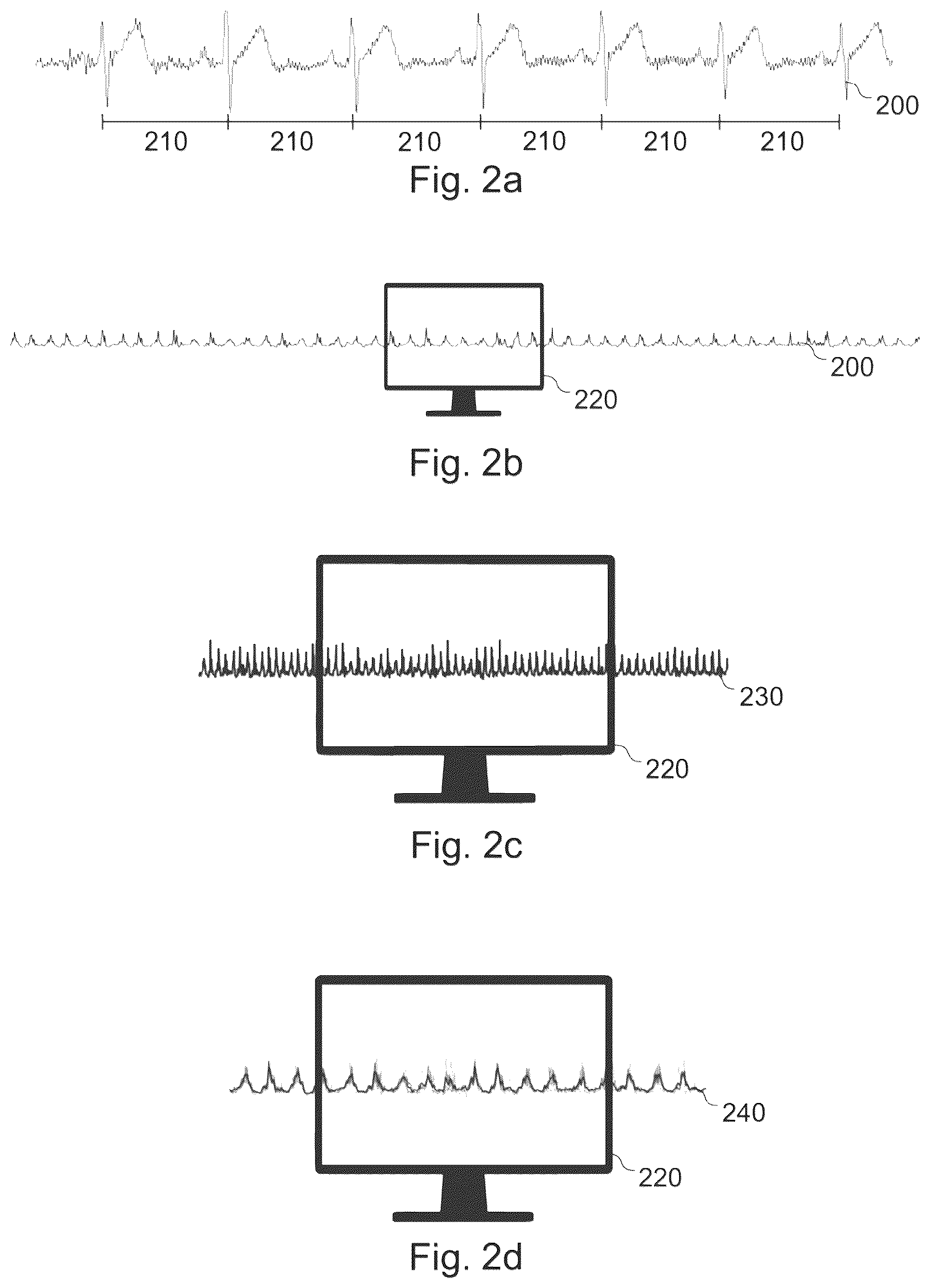 Patent US12350072 Figure 2 – Method, apparatus, system and computer program for processing an almost-periodic input signal