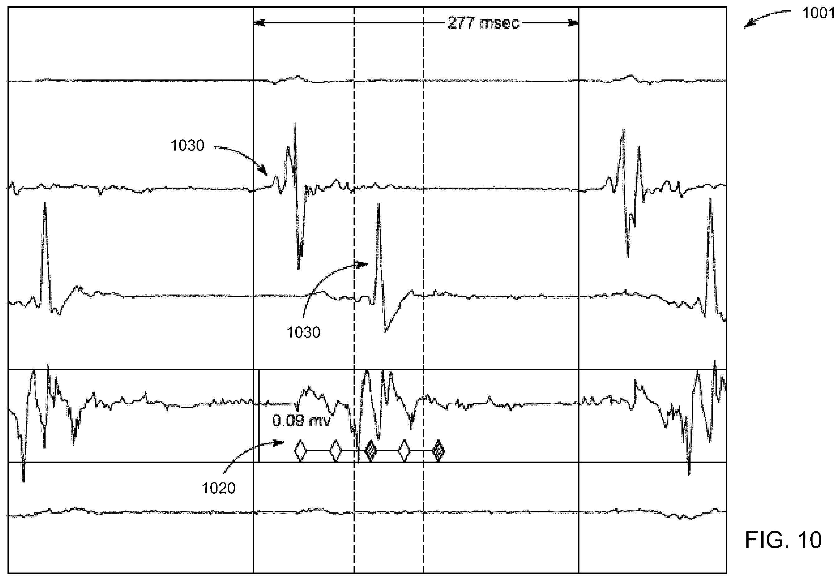 Patent US12350073 Figure 10 – Signal and correction processing for anatomical structure mapping data