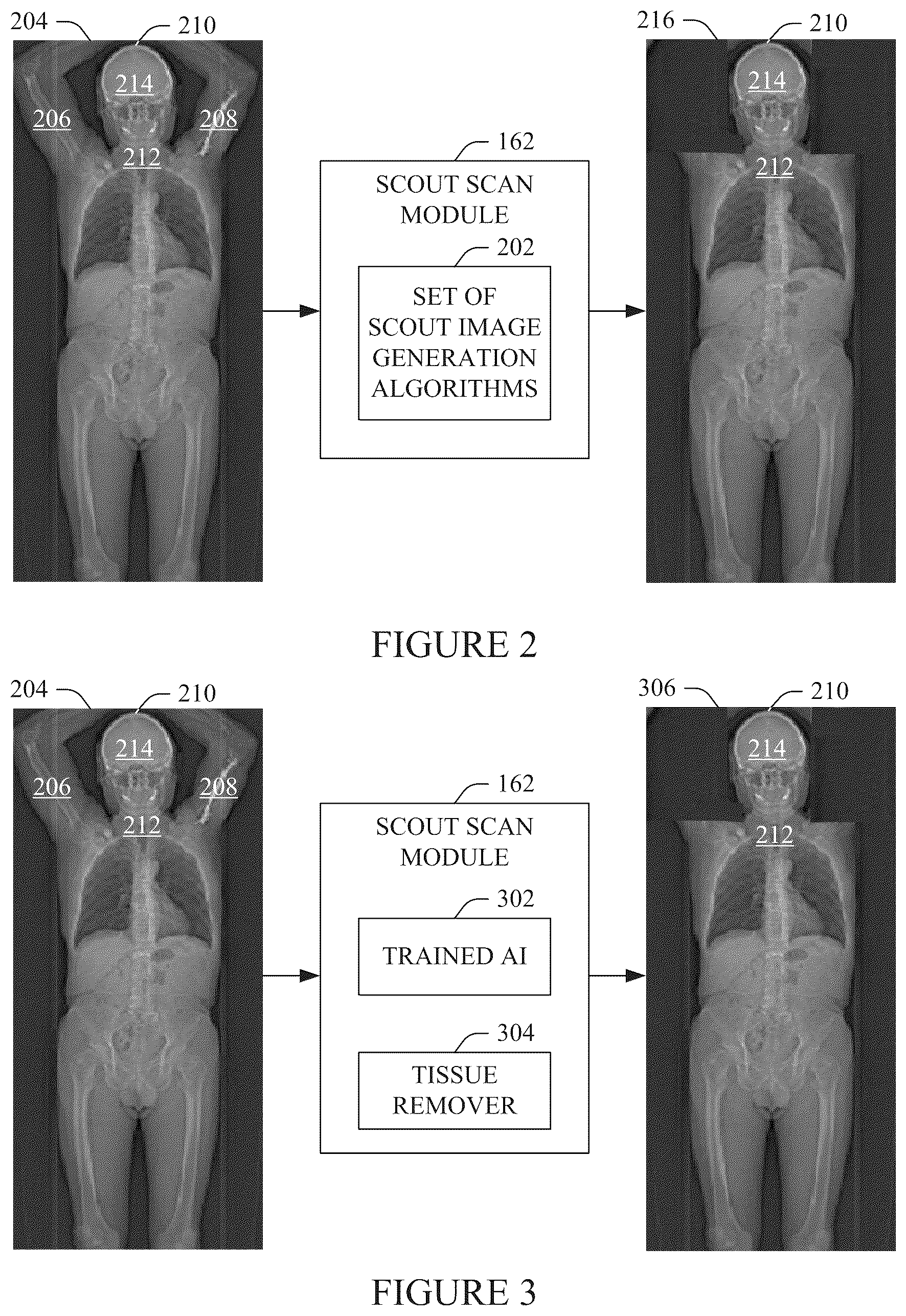 Patent US12350081 Figure 2 – Method and system for subject position instructions during an imaging examination