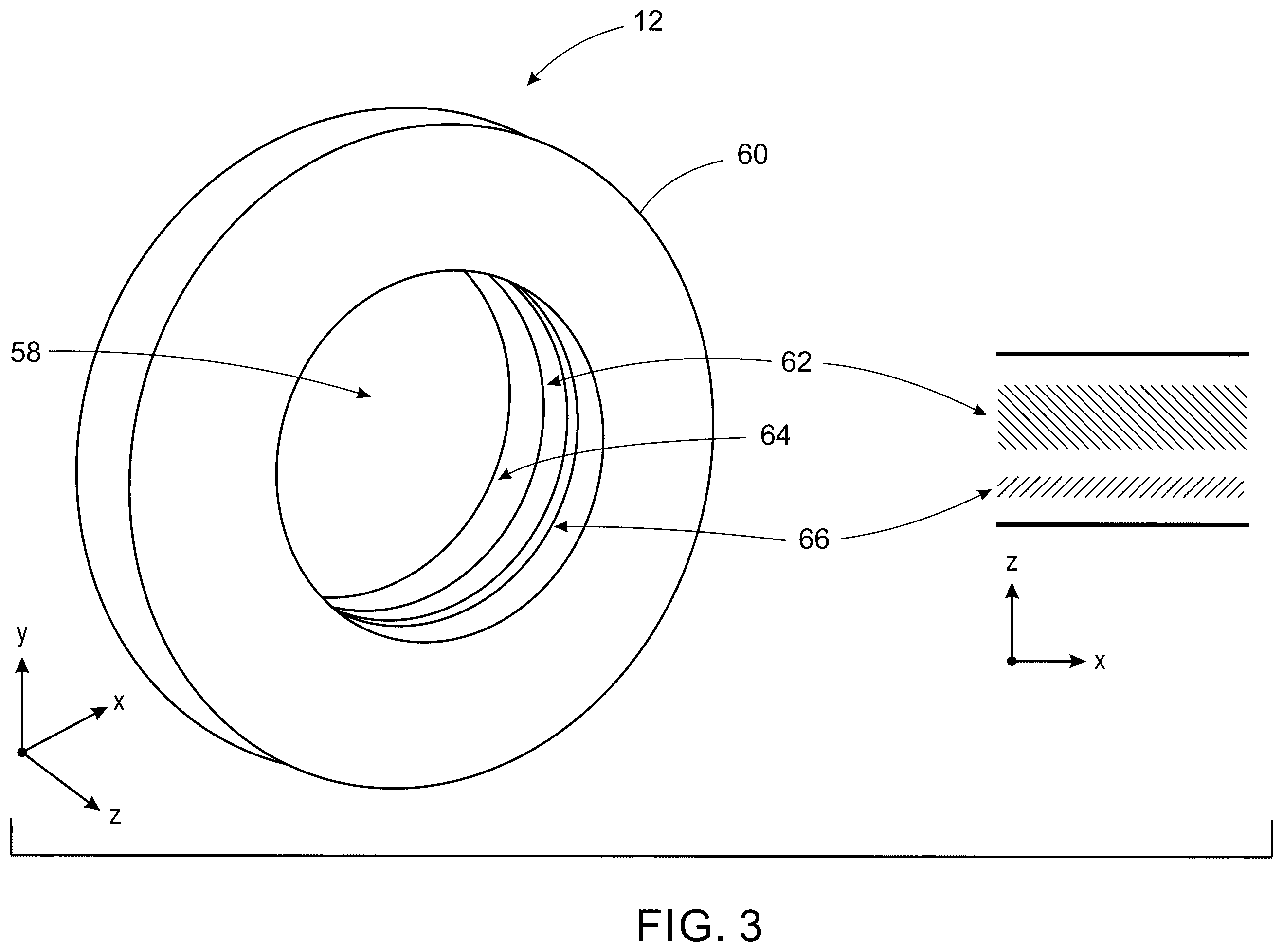 Patent US12350084 Figure 3 – System and method for LiDAR guided auto gating in a CT imaging system