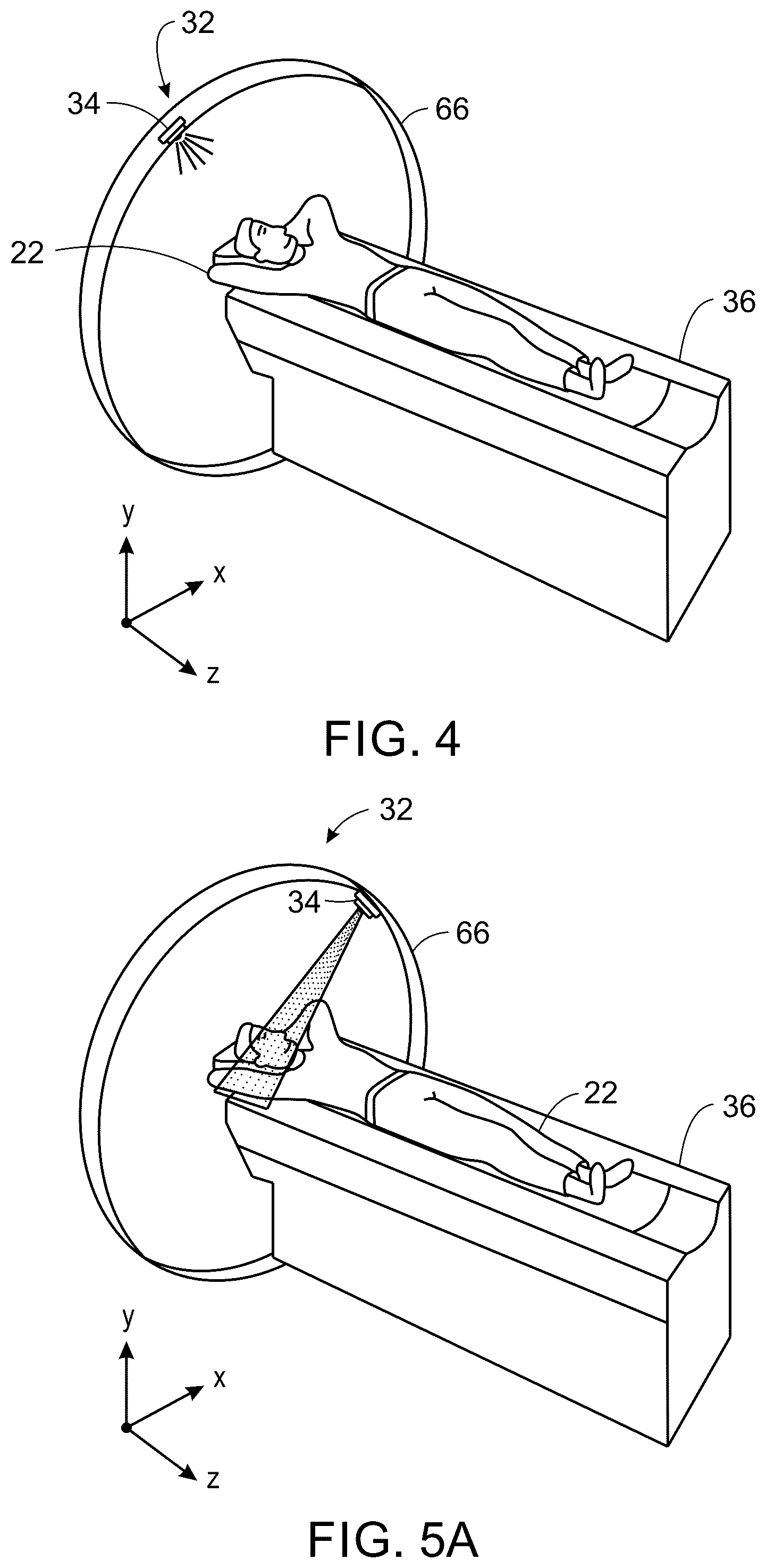 Patent US12350084 Figure 4 – System and method for LiDAR guided auto gating in a CT imaging system