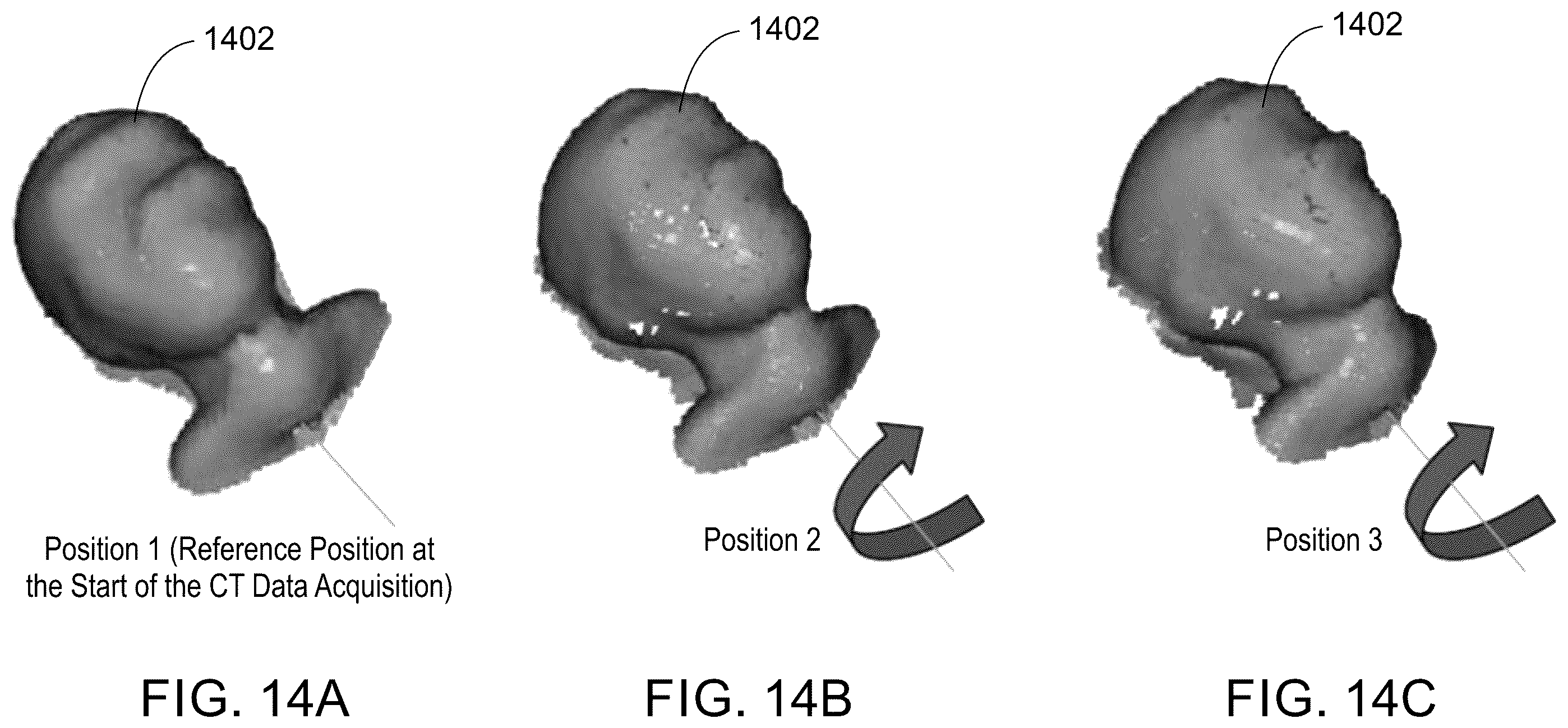 Patent US12350084 Figure 13 – System and method for LiDAR guided auto gating in a CT imaging system