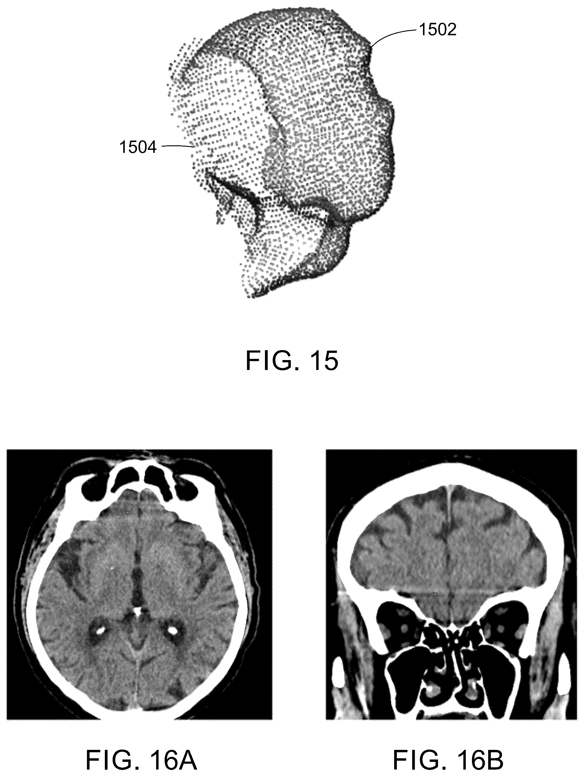 Patent US12350084 Figure 14 – System and method for LiDAR guided auto gating in a CT imaging system