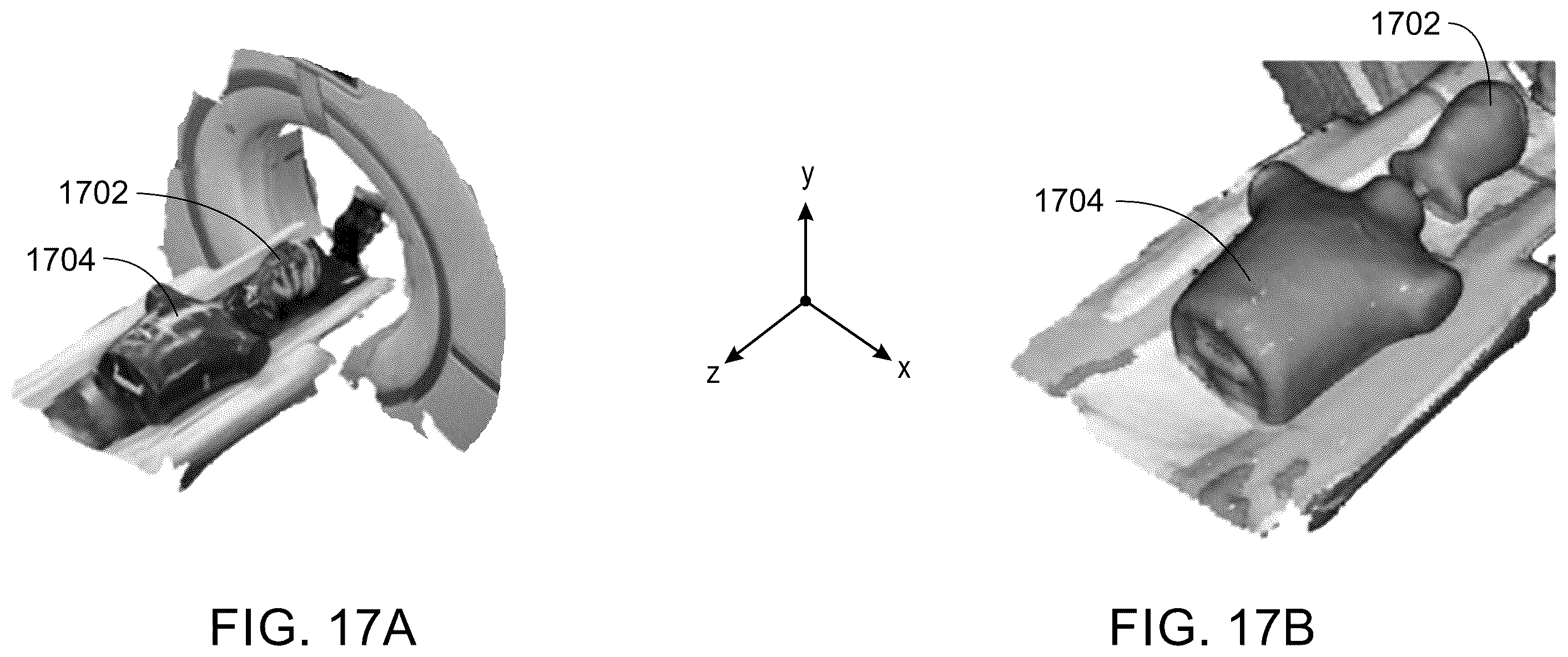 Patent US12350084 Figure 15 – System and method for LiDAR guided auto gating in a CT imaging system