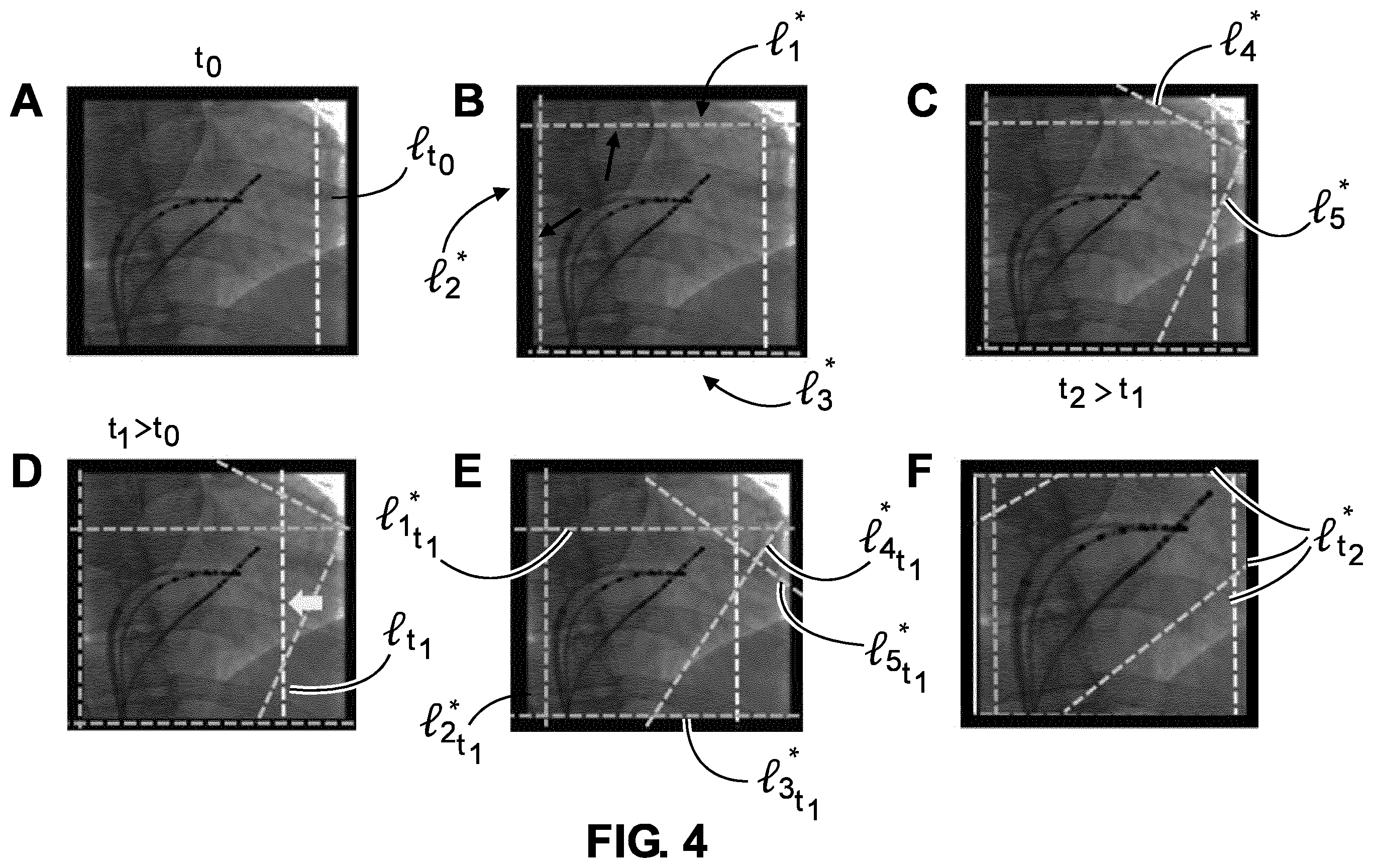 Patent US12350089 Figure 4 – Adaptive collimation for interventional x-ray