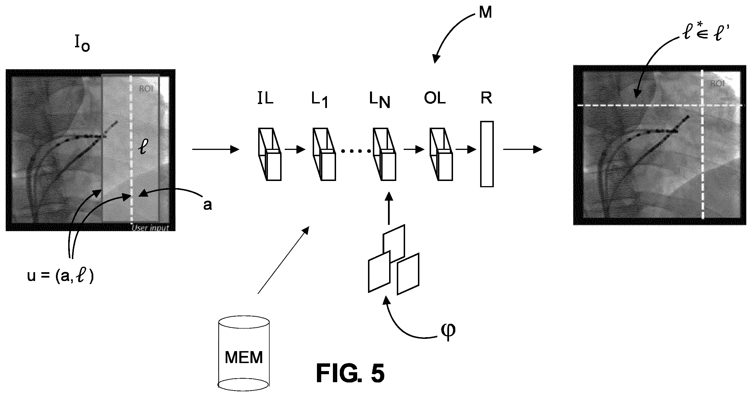 Patent US12350089 Figure 5 – Adaptive collimation for interventional x-ray