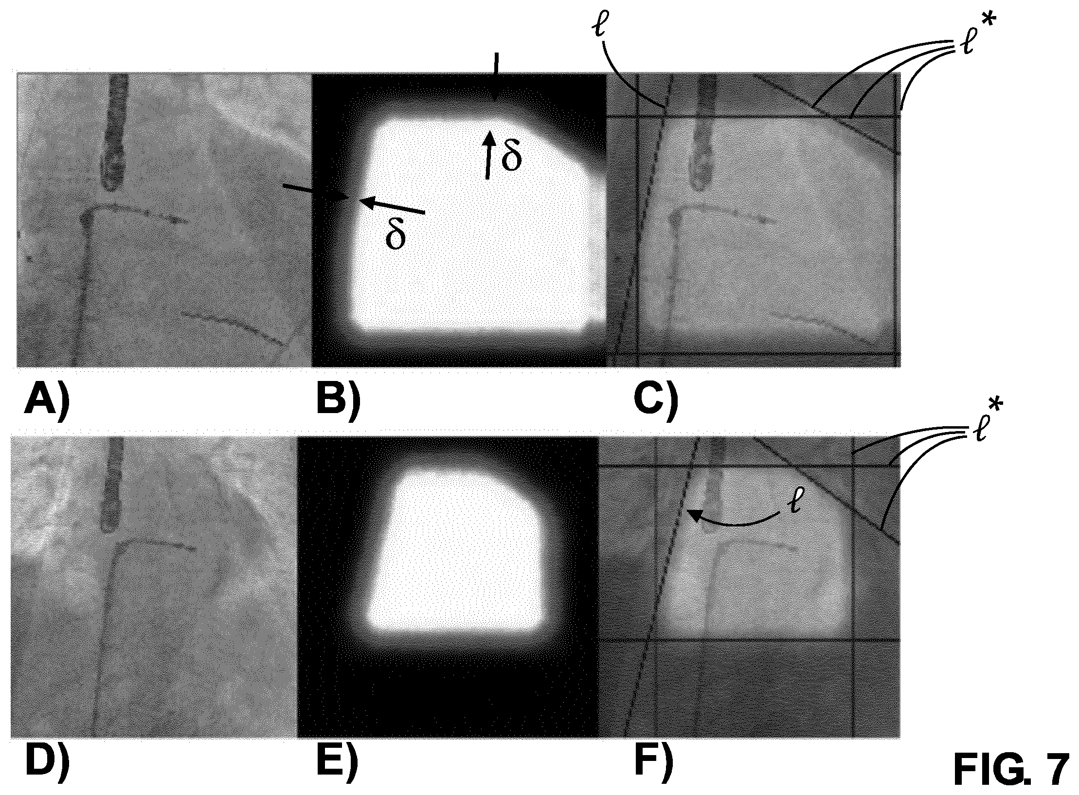 Patent US12350089 Figure 7 – Adaptive collimation for interventional x-ray